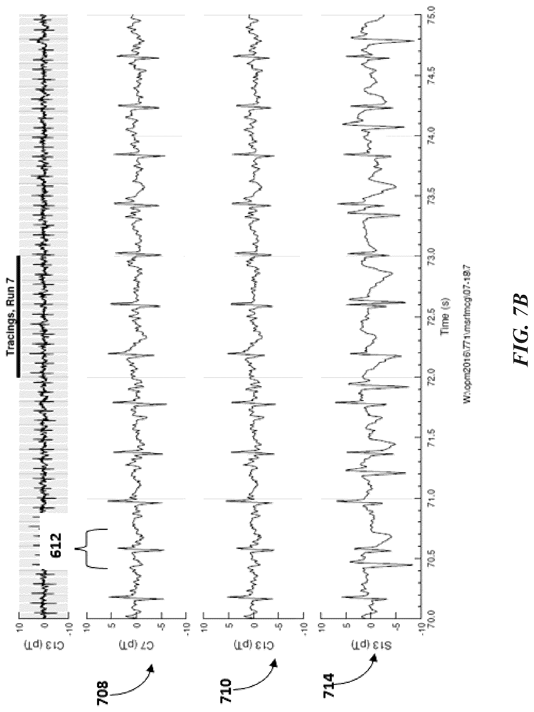 Patent US12097032 Figure 10 – Machine differentiation of abnormalities in bioelectromagnetic fields