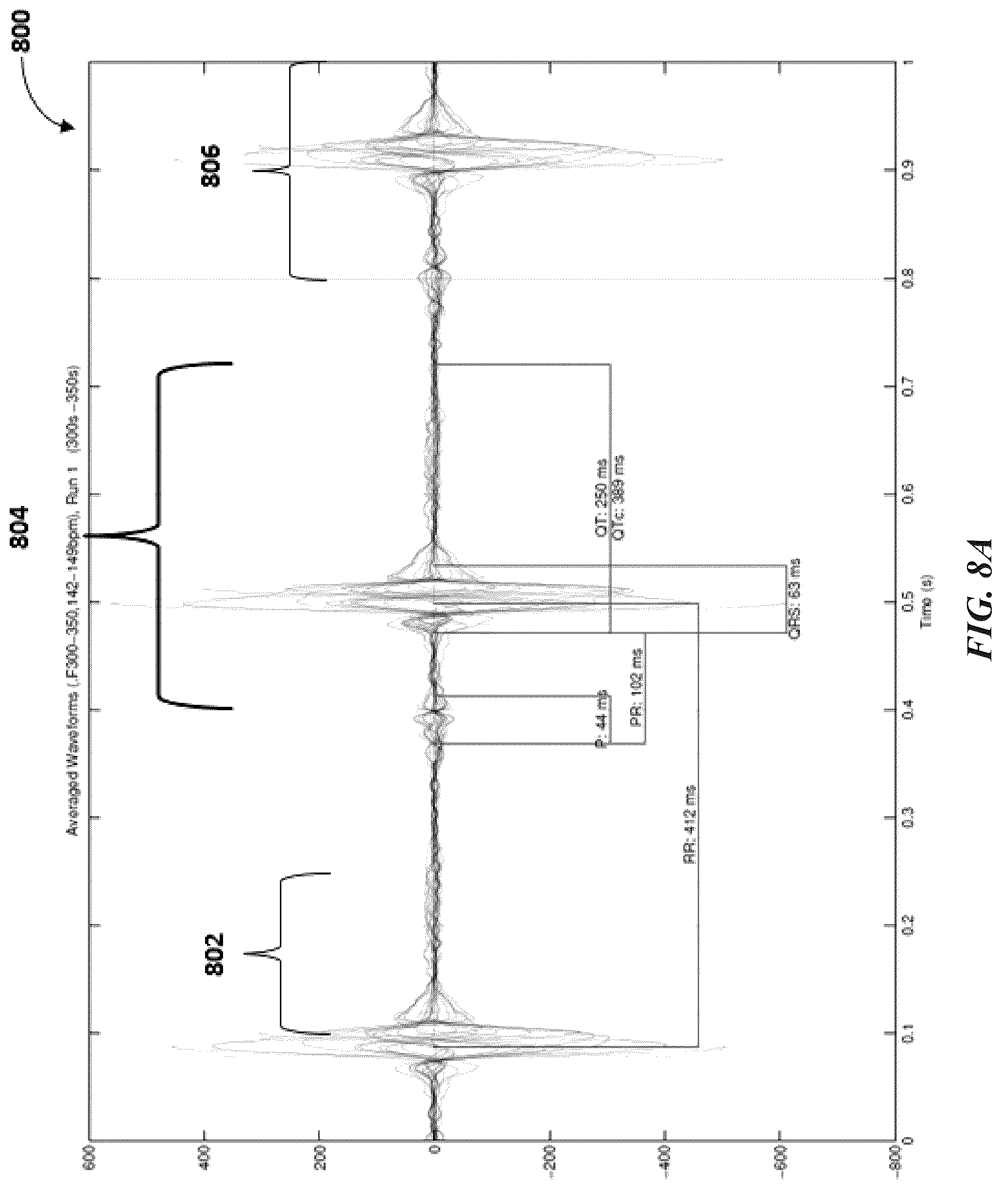 Patent US12097032 Figure 11 – Machine differentiation of abnormalities in bioelectromagnetic fields
