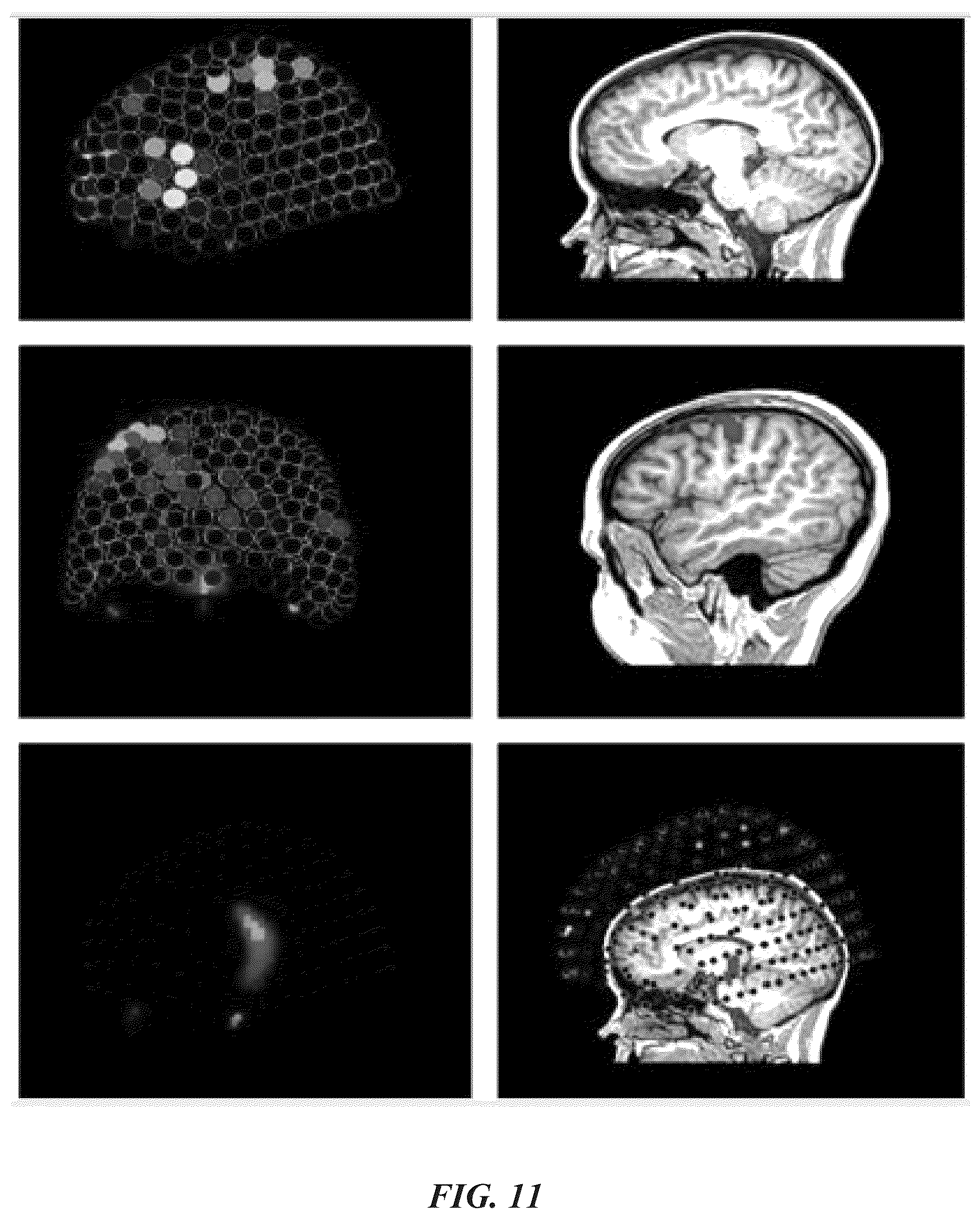 Patent US12097032 Figure 15 – Machine differentiation of abnormalities in bioelectromagnetic fields