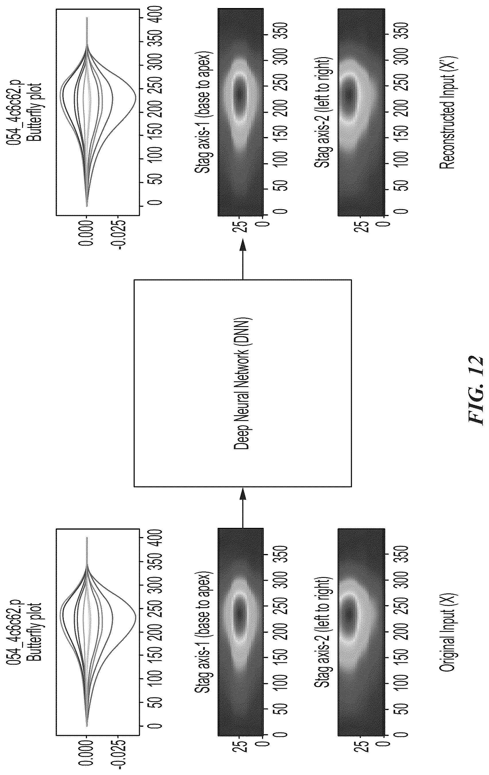 Patent US12097032 Figure 16 – Machine differentiation of abnormalities in bioelectromagnetic fields
