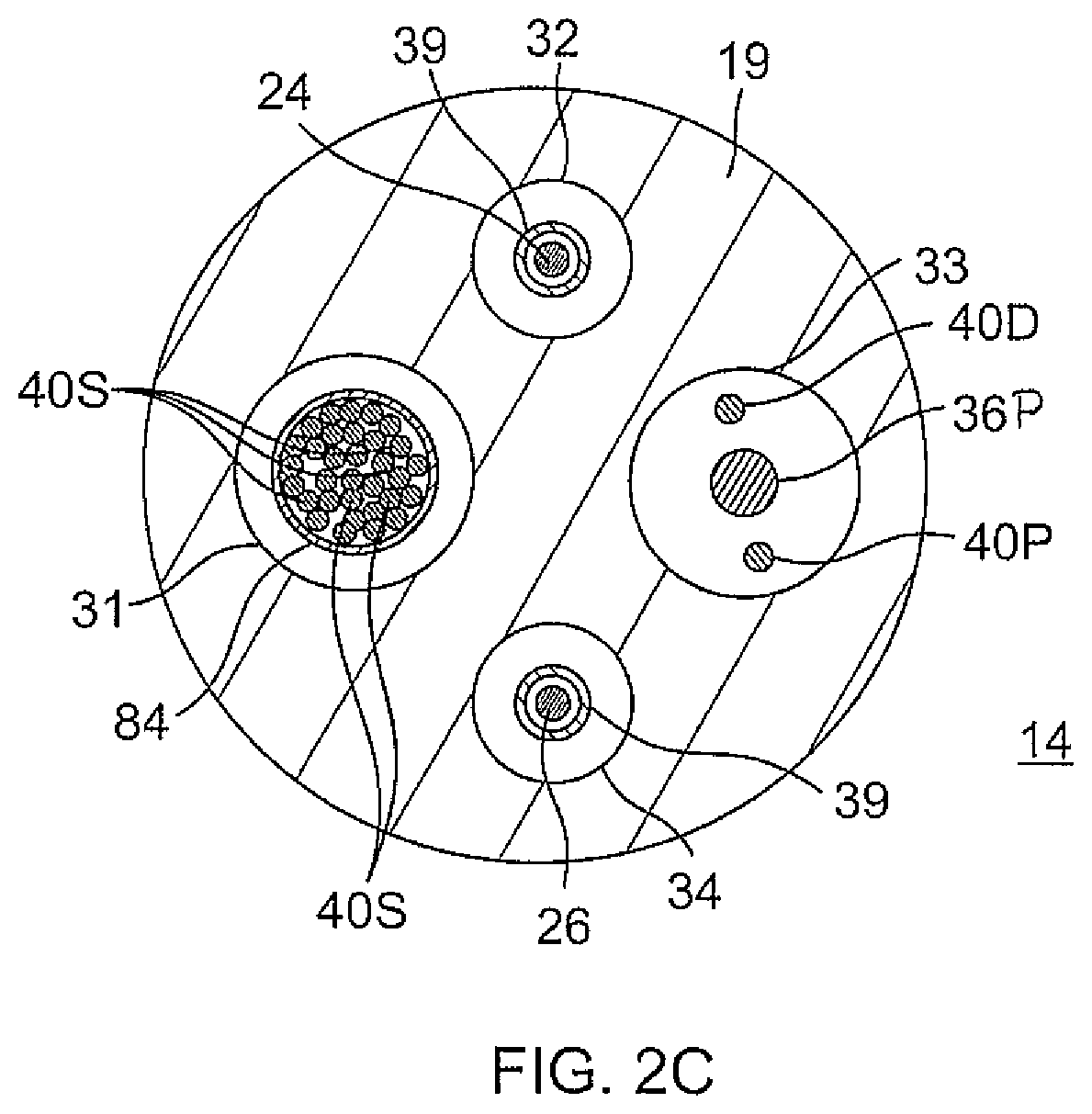 Patent US12097034 Figure 4 – Catheter with stacked spine electrode assembly