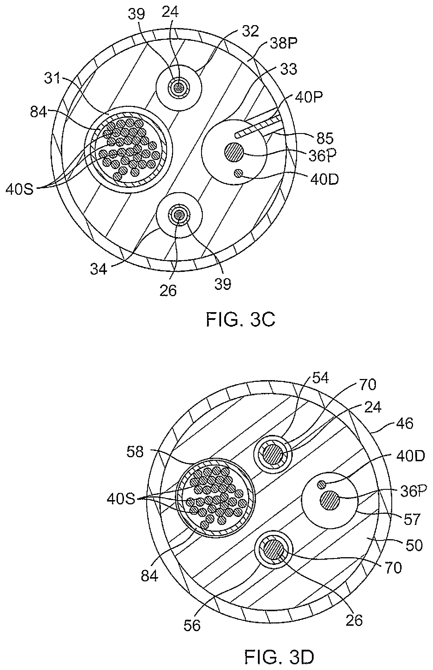 Patent US12097034 Figure 7 – Catheter with stacked spine electrode assembly