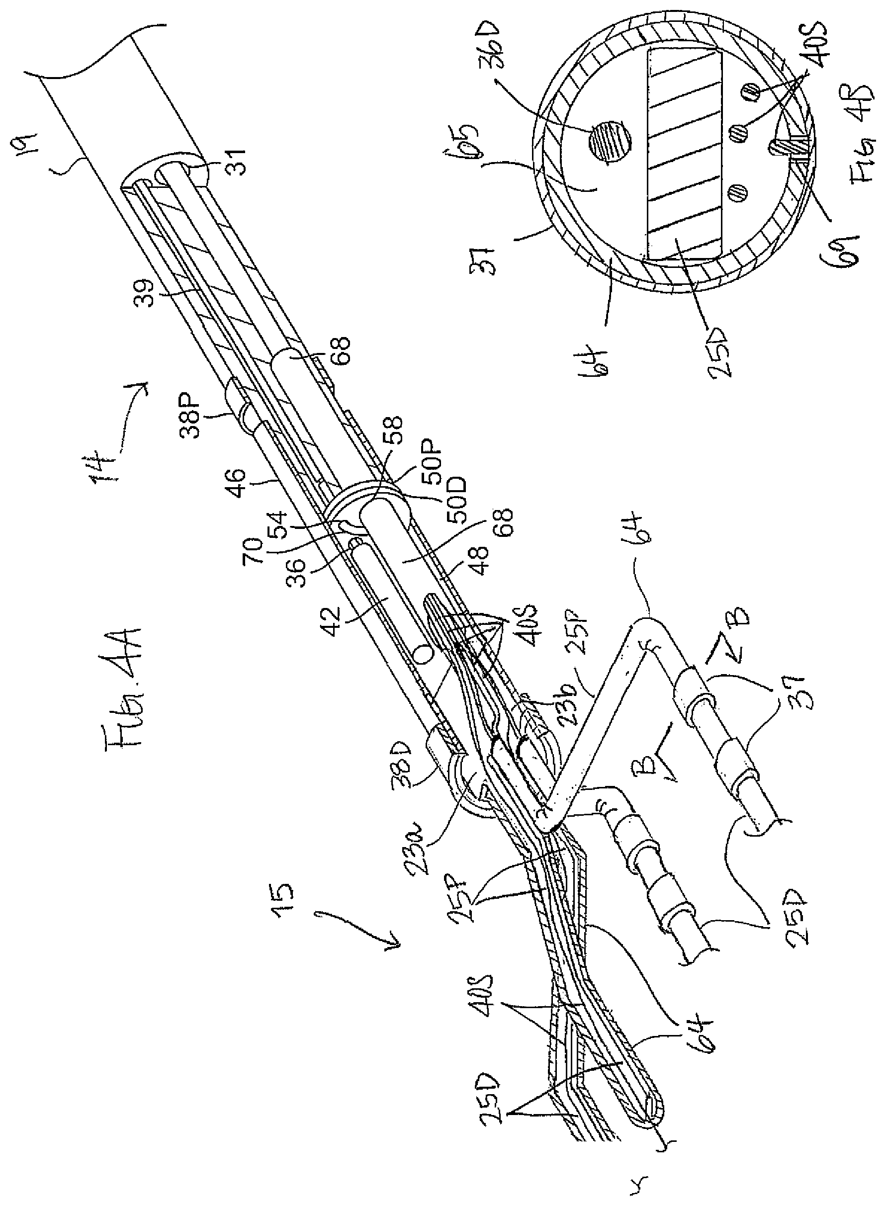 Patent US12097034 Figure 8 – Catheter with stacked spine electrode assembly