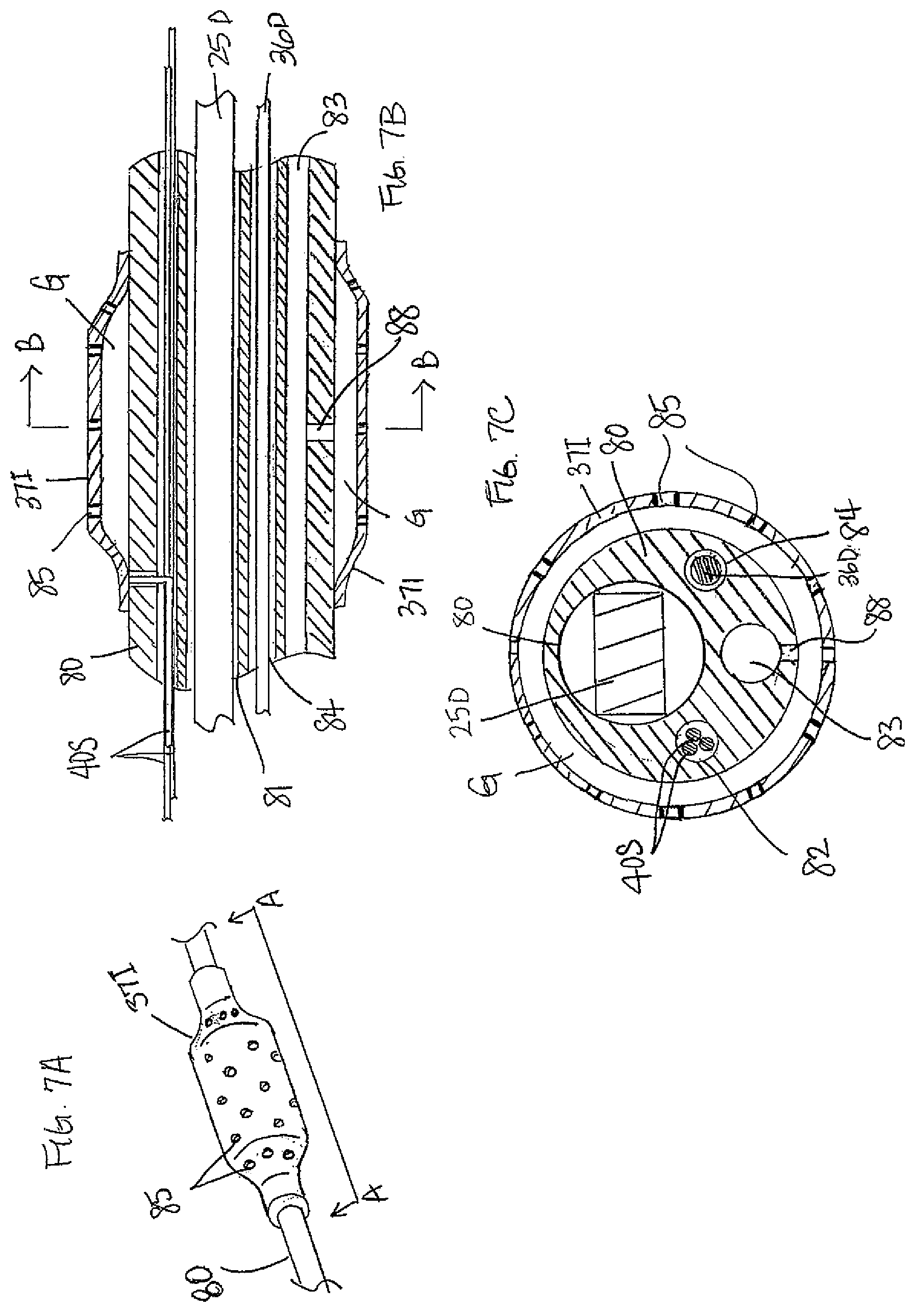 Patent US12097034 Figure 10 – Catheter with stacked spine electrode assembly