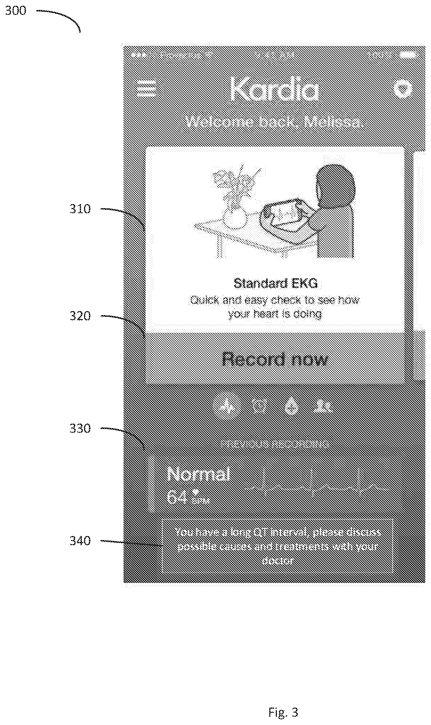 Patent US12097035 Figure 3 – Systems and methods of QT interval analysis