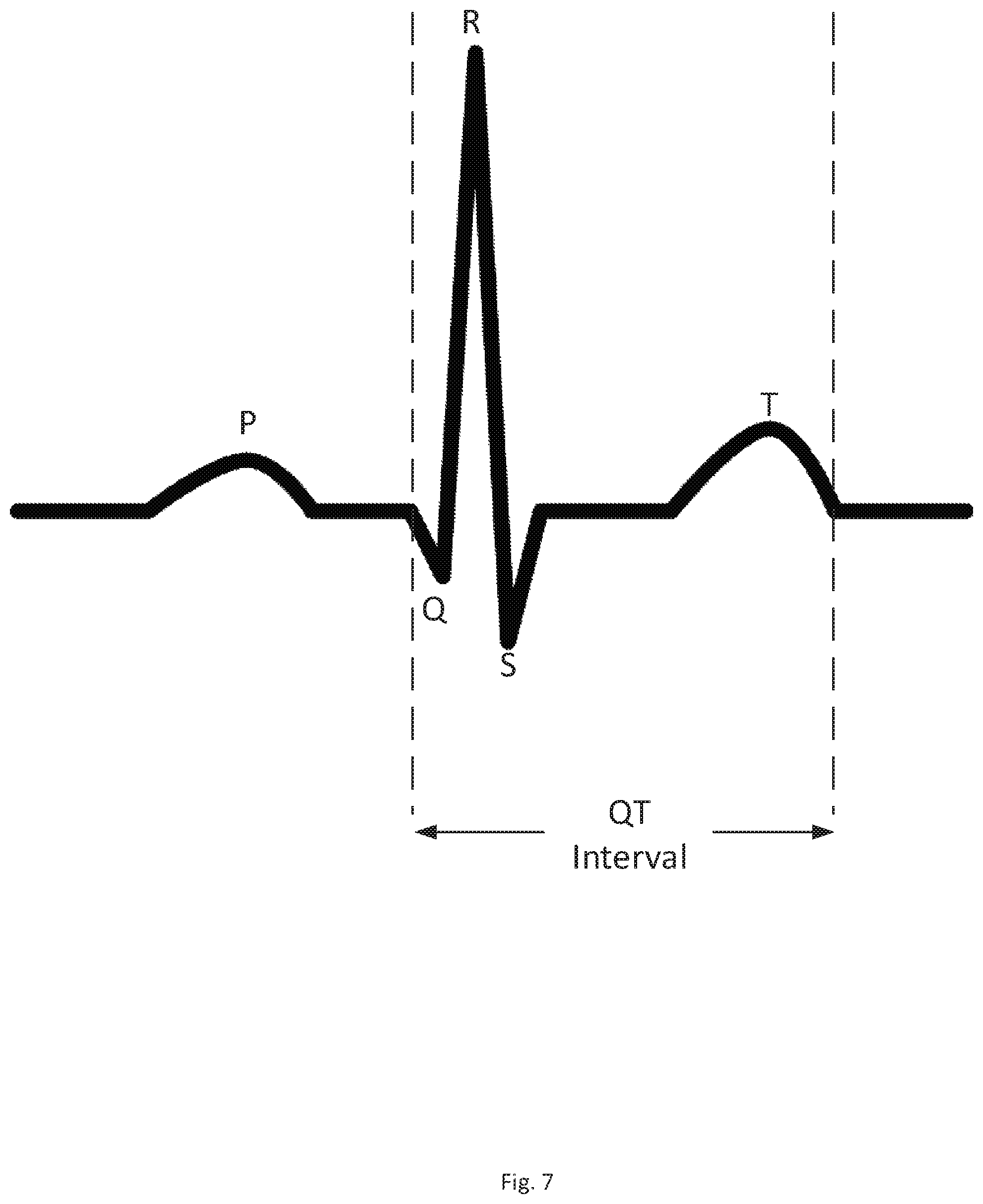Patent US12097035 Figure 7 – Systems and methods of QT interval analysis