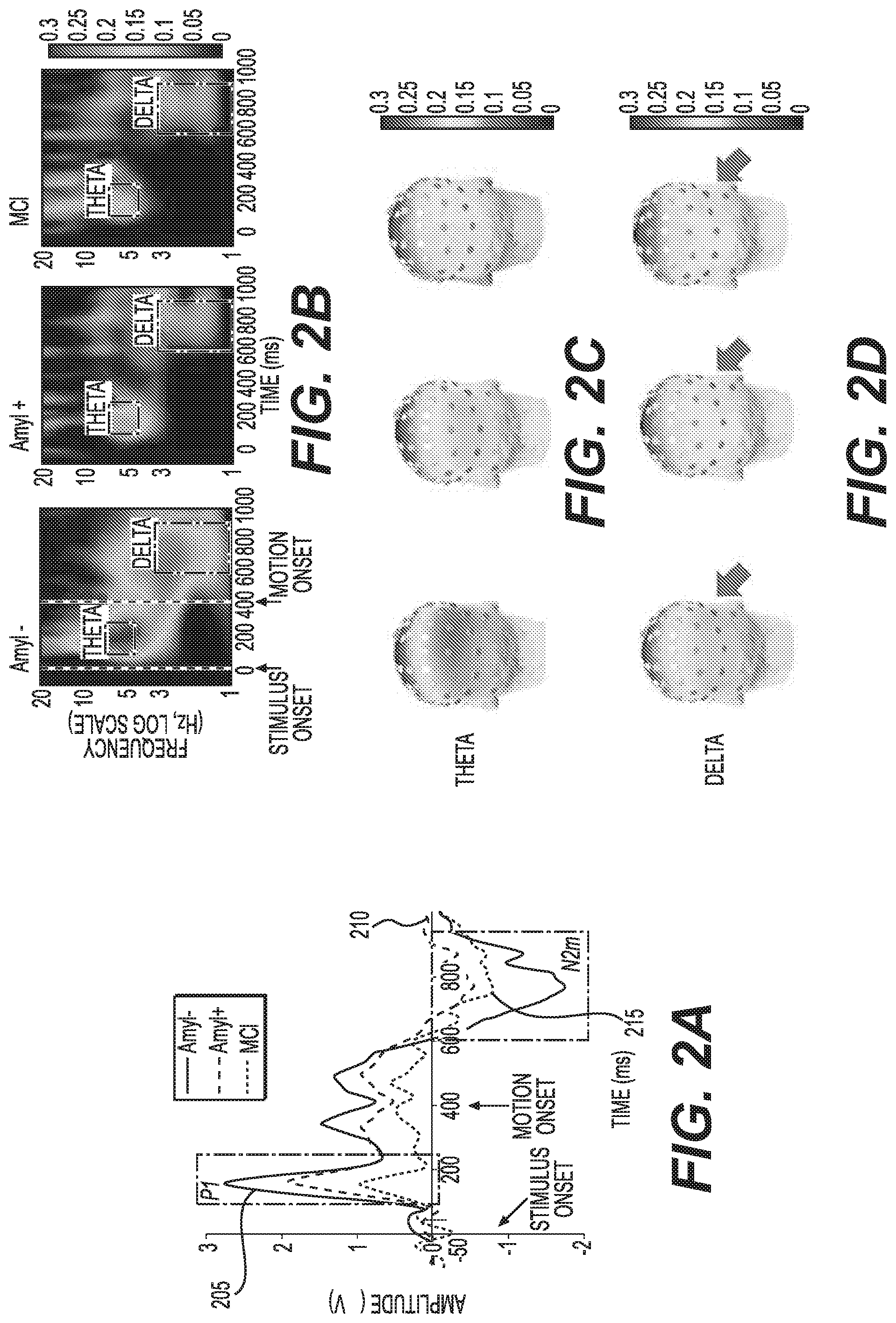 Patent US12097037 Figure 2 – System, method and computer-accessible medium for determining possibility/likelihood of mental disorder