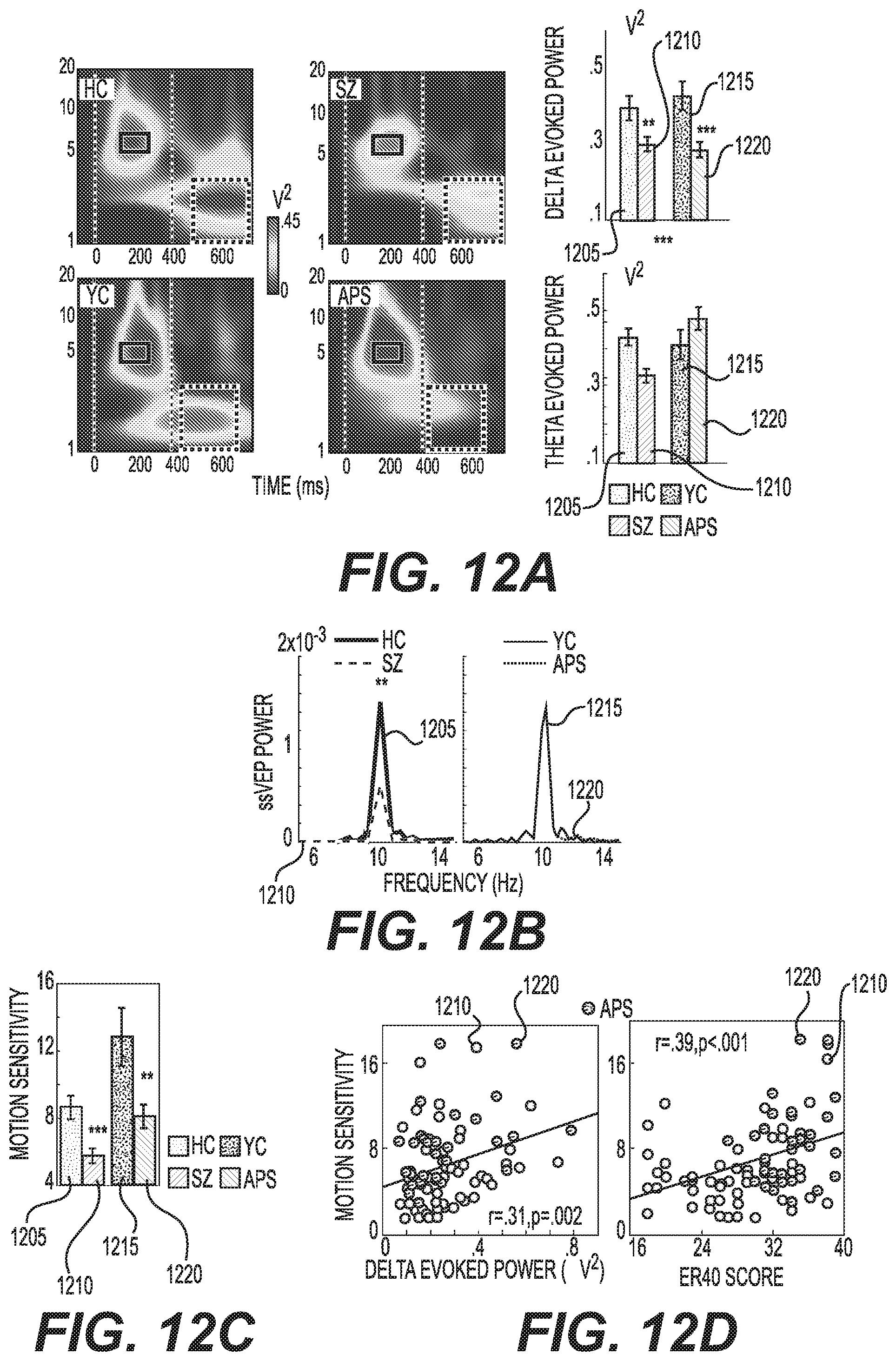 Patent US12097037 Figure 12 – System, method and computer-accessible medium for determining possibility/likelihood of mental disorder
