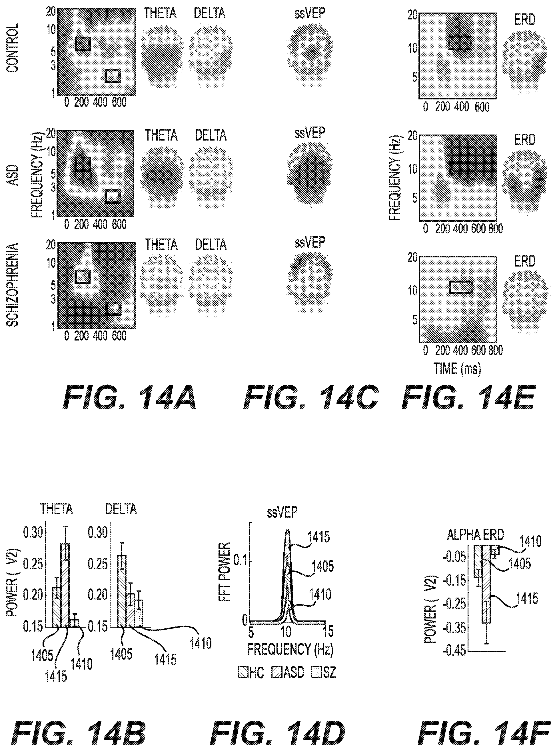 Patent US12097037 Figure 14 – System, method and computer-accessible medium for determining possibility/likelihood of mental disorder