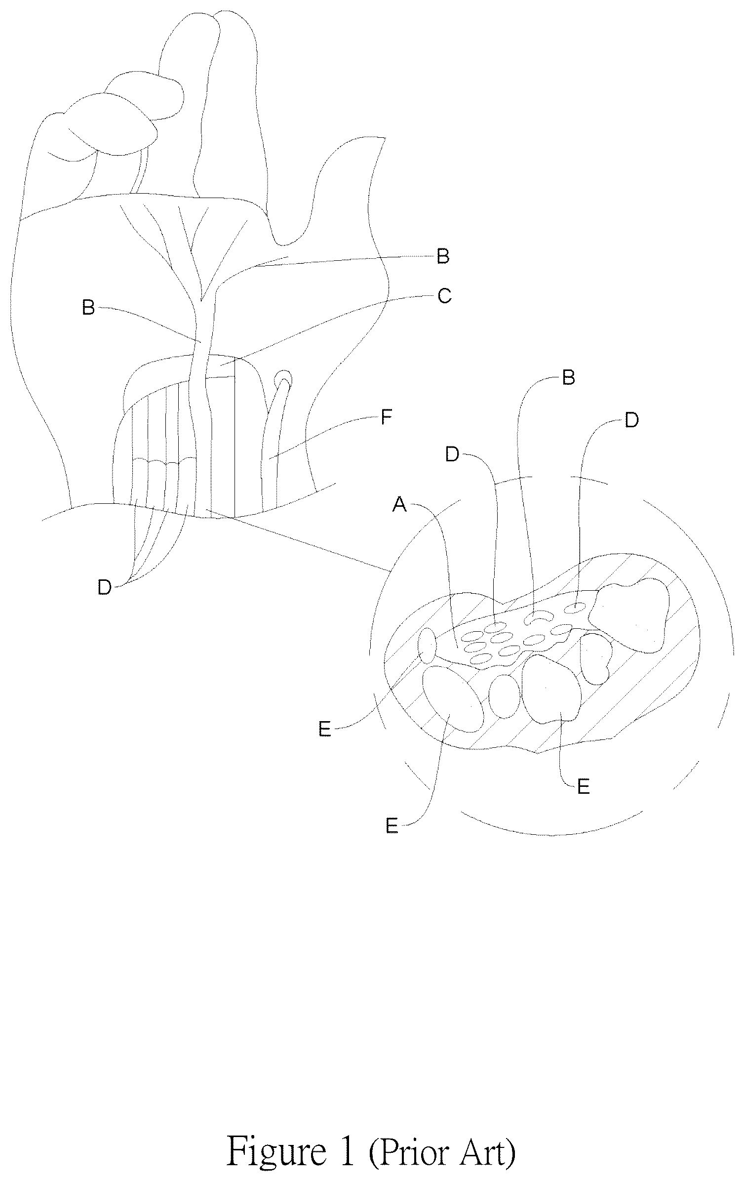 Patent US12097042 Figure 1 – Method for detecting carpal tunnel using an ultrasonic detection device