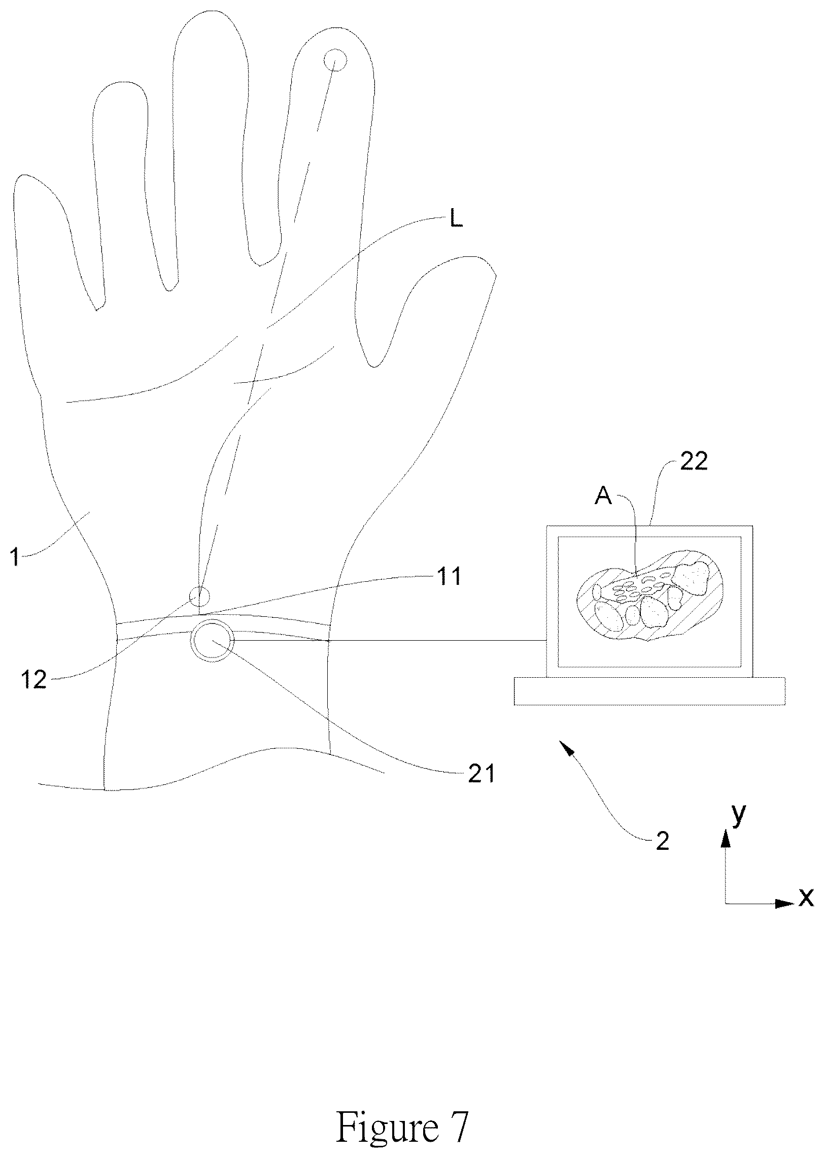 Patent US12097042 Figure 7 – Method for detecting carpal tunnel using an ultrasonic detection device