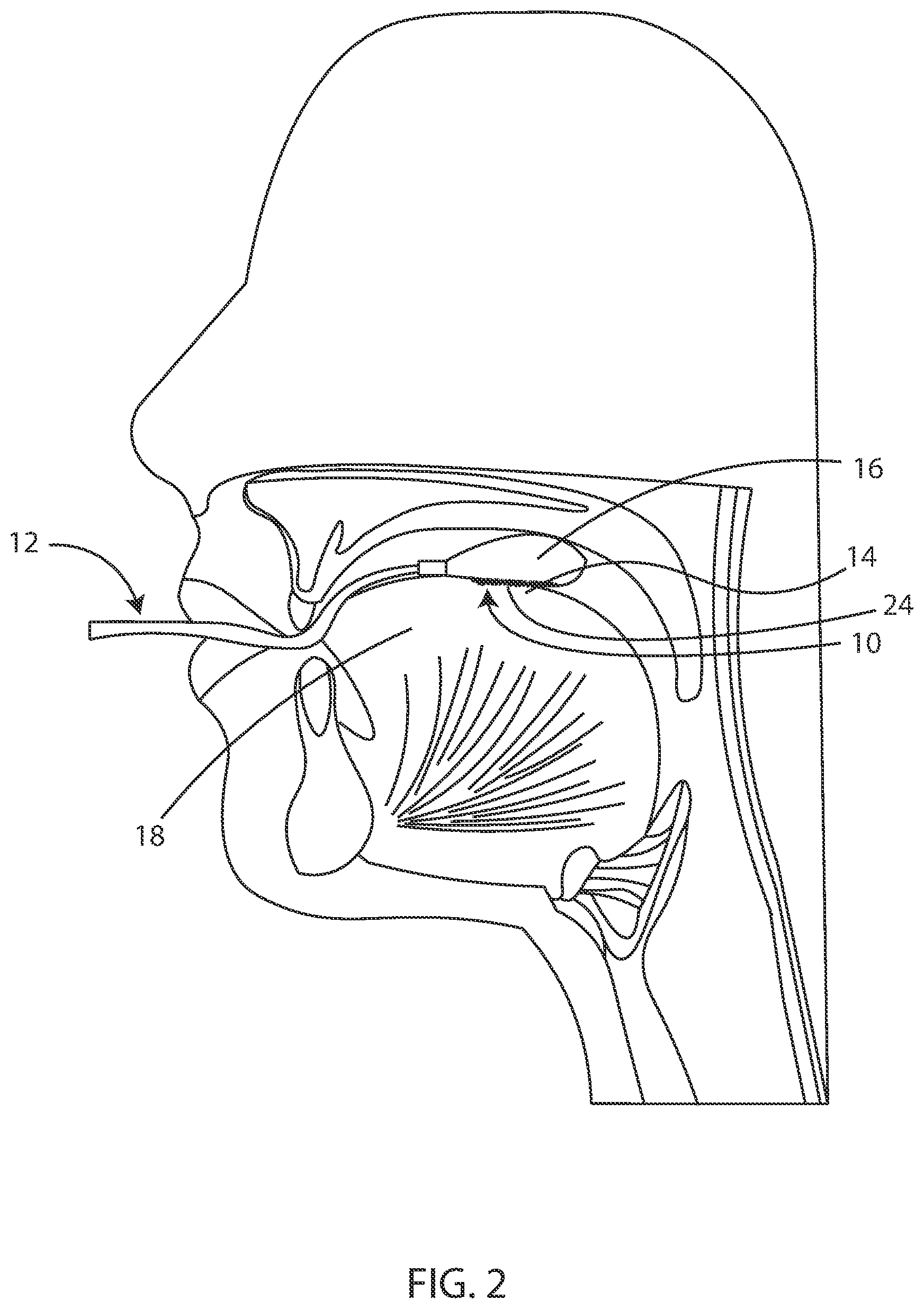 Patent US12097045 Figure 2 – Slip-resistance patch for oral devices