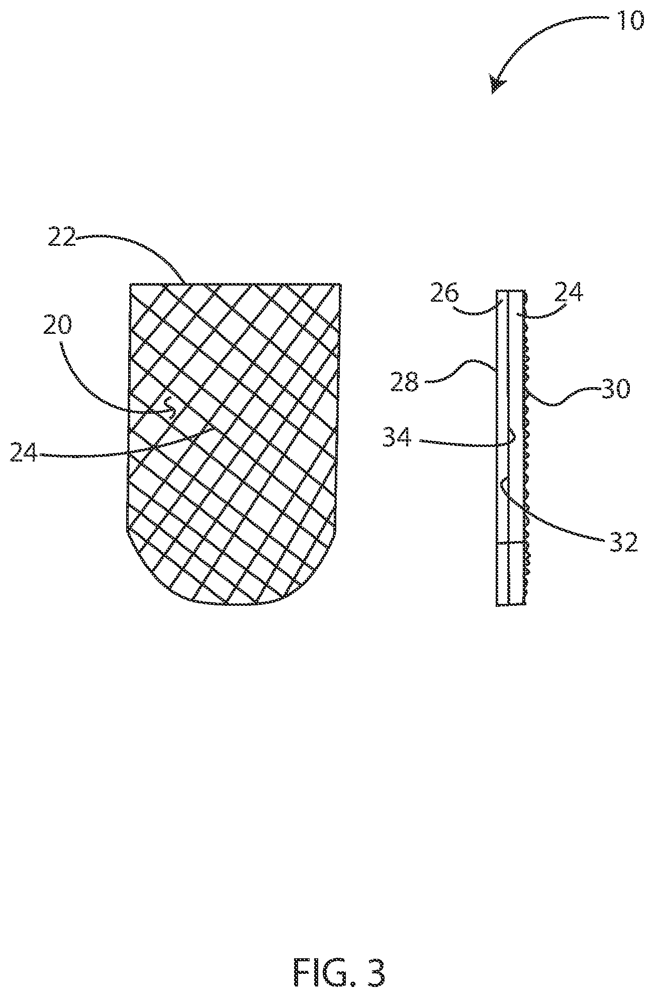 Patent US12097045 Figure 3 – Slip-resistance patch for oral devices