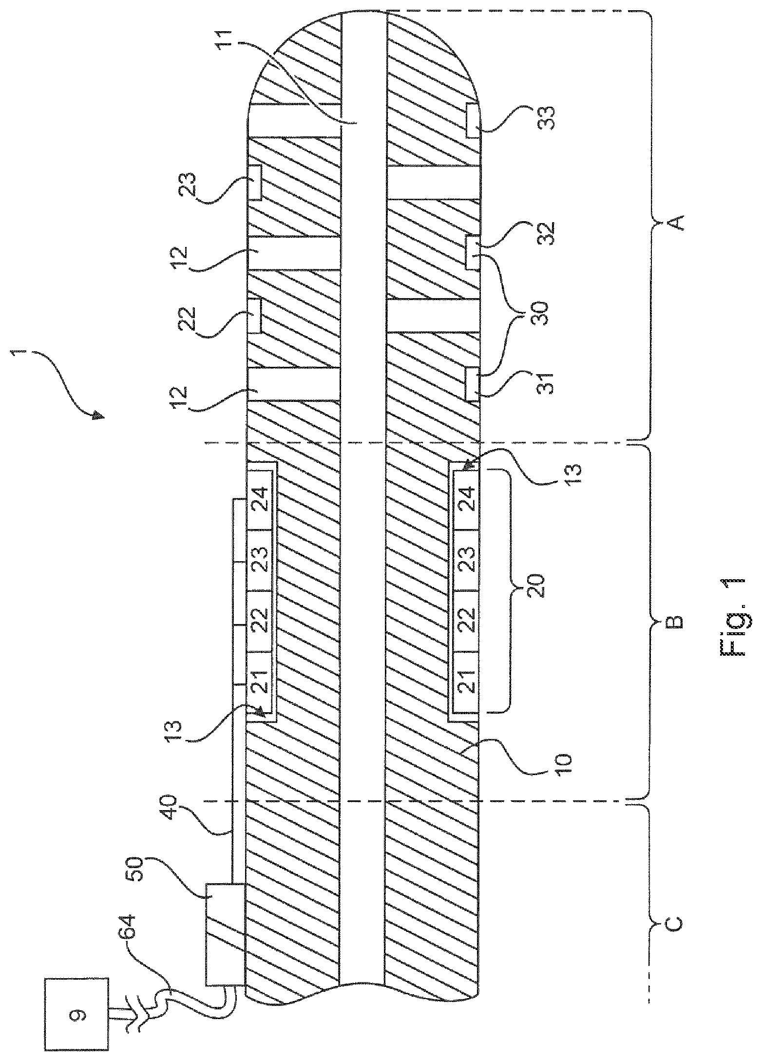 Patent US12097047 Figure 1 – Device for drainage of the brain