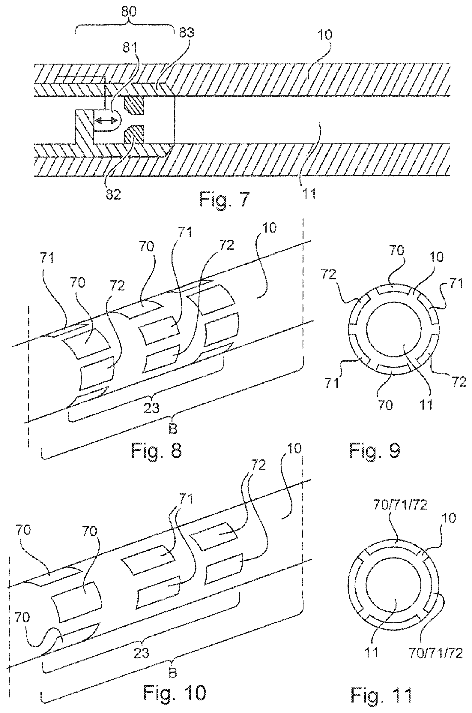 Patent US12097047 Figure 5 – Device for drainage of the brain