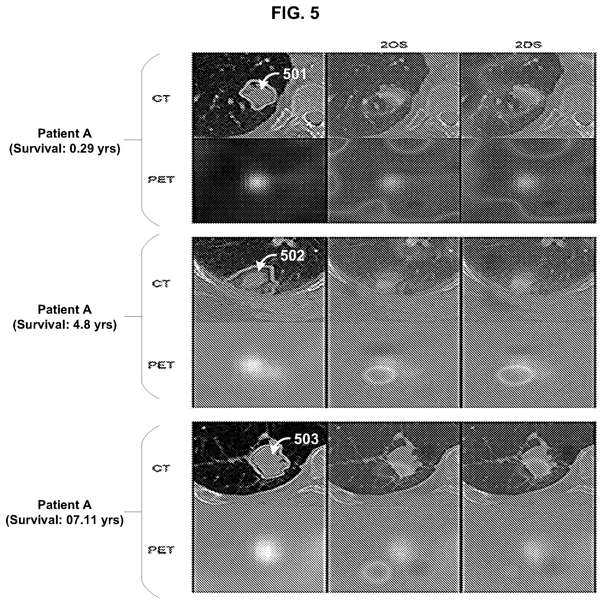 Patent US12097050 Figure 5 – Methods and systems for image segmentation and analysis