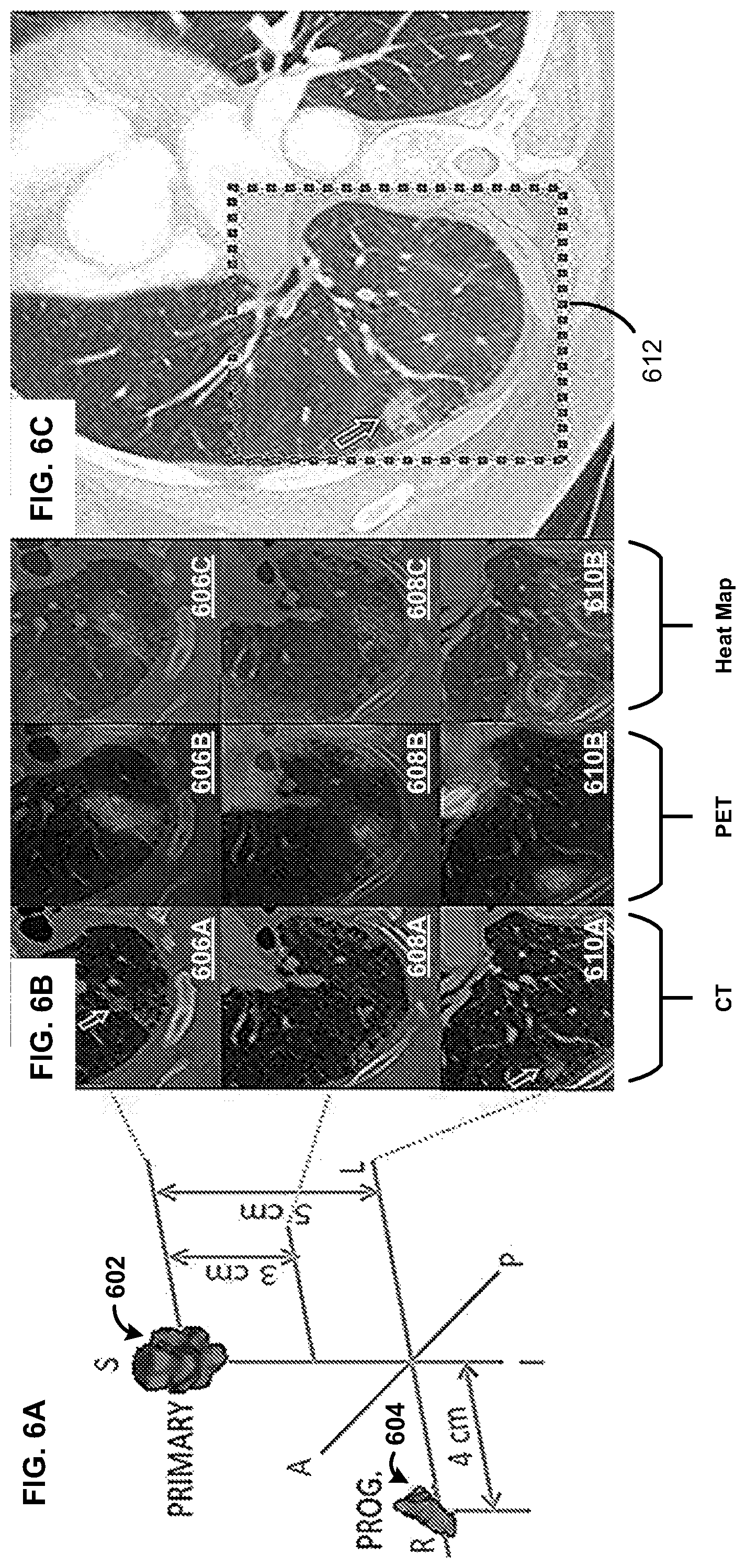 Patent US12097050 Figure 6 – Methods and systems for image segmentation and analysis