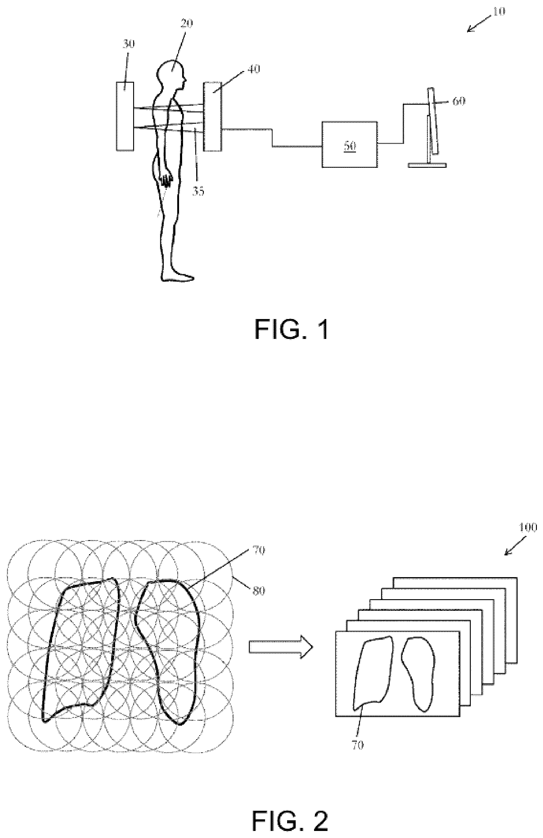 Patent US12097053 Figure 1 – Method of obtaining x-ray images