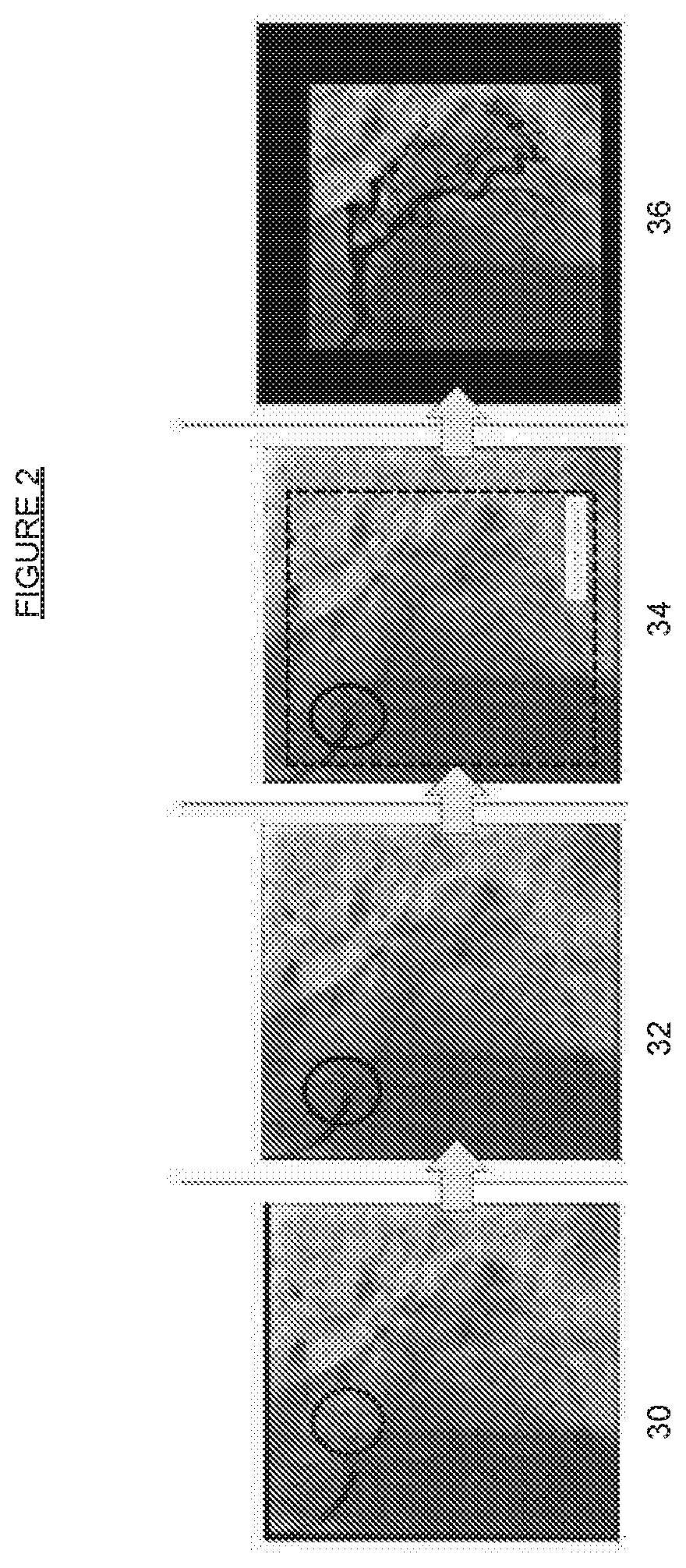 Patent US12097054 Figure 2 – Imaging system for use in a fluoroscopy procedure