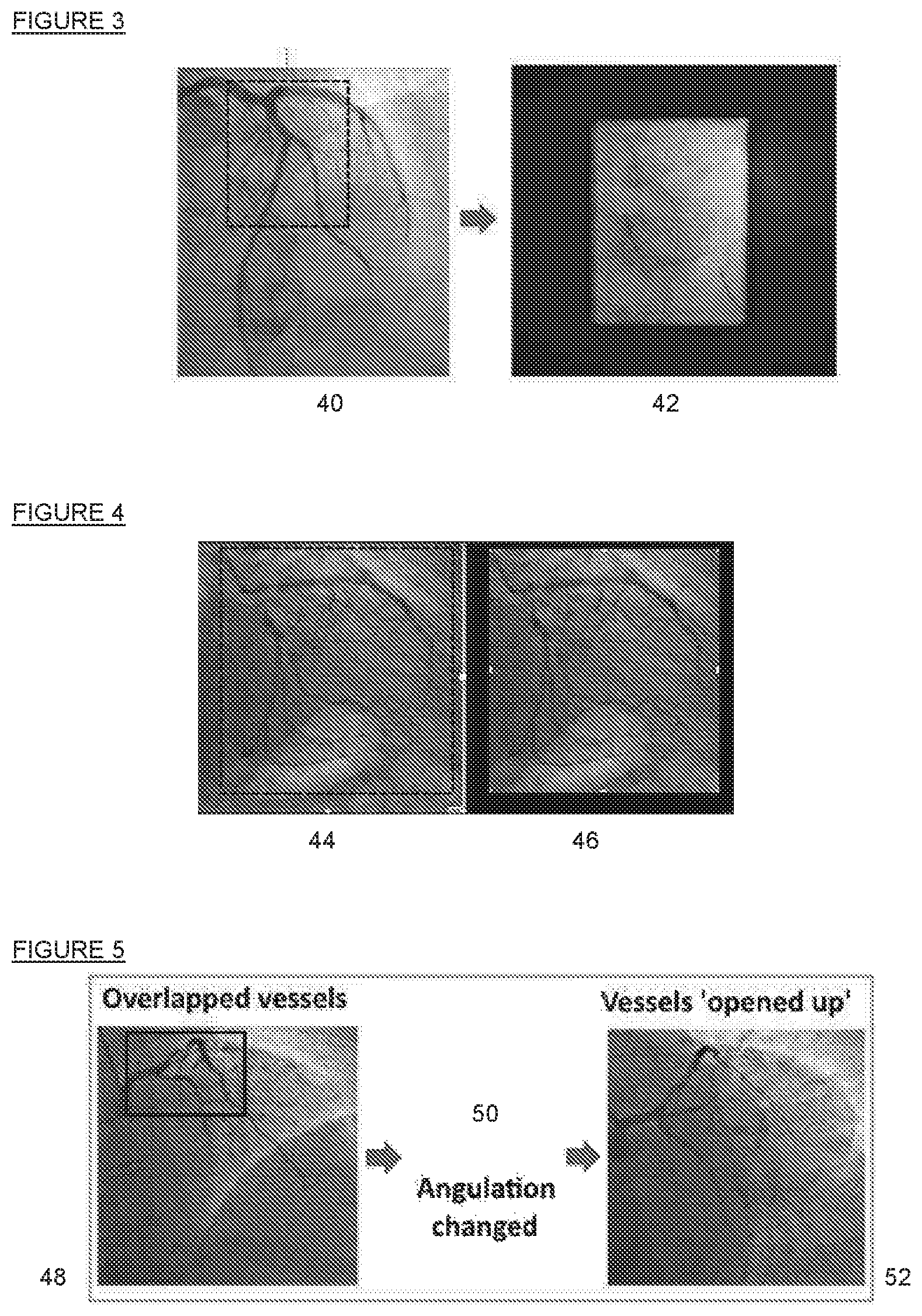 Patent US12097054 Figure 3 – Imaging system for use in a fluoroscopy procedure