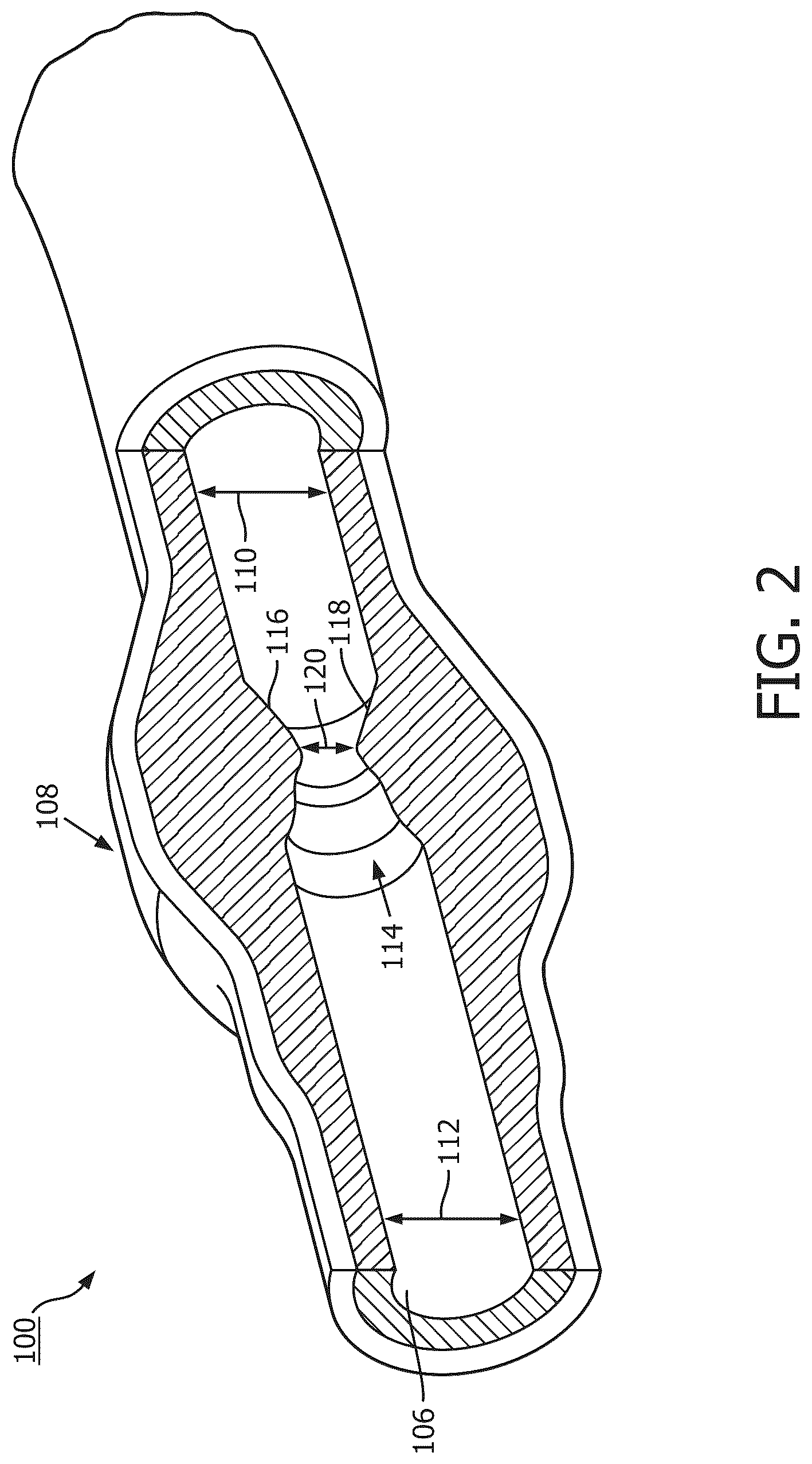 Patent US12097058 Figure 2 – Intravascular device movement speed guidance and associated devices, systems, and methods