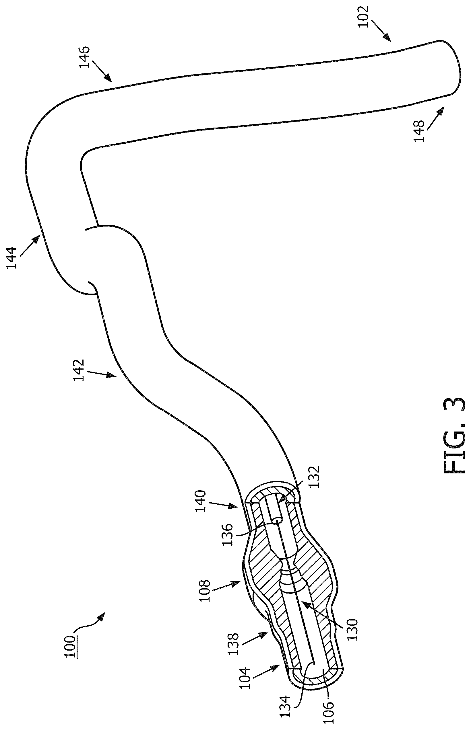 Patent US12097058 Figure 3 – Intravascular device movement speed guidance and associated devices, systems, and methods