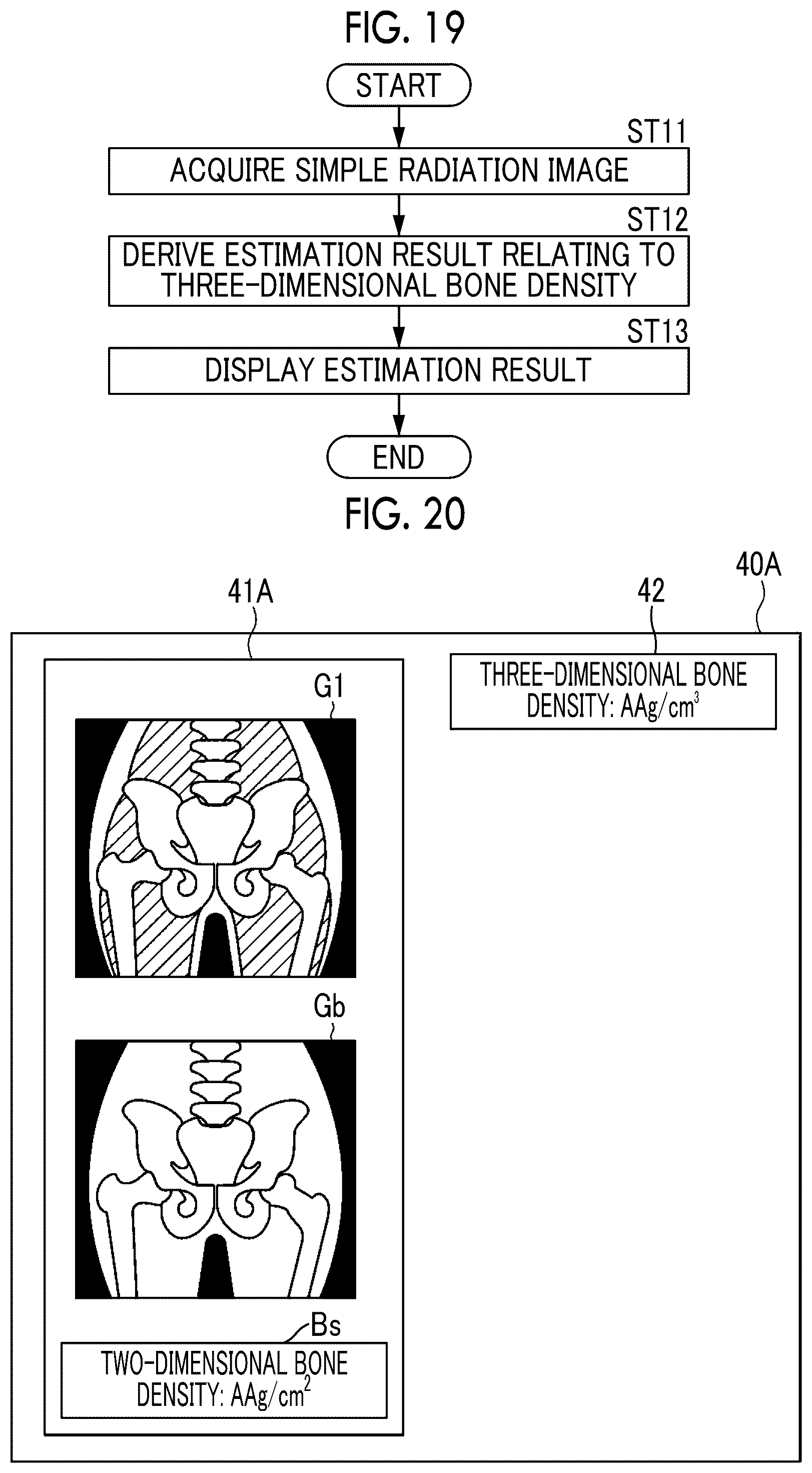 Patent US12097062 Figure 11 – Estimation device, estimation method, and estimation program