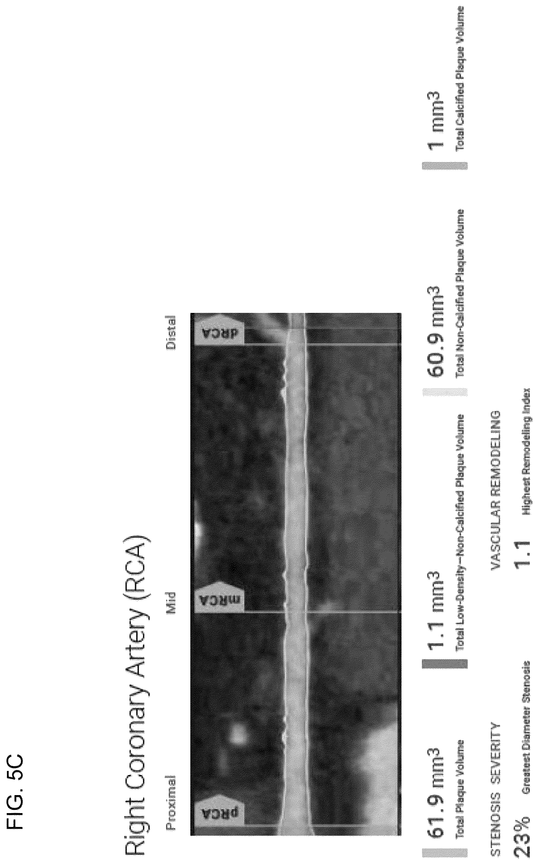 Patent US12097063 Figure 13 – Systems, methods, and devices for medical image analysis, diagnosis, risk stratification, decision making and/or disease tracking