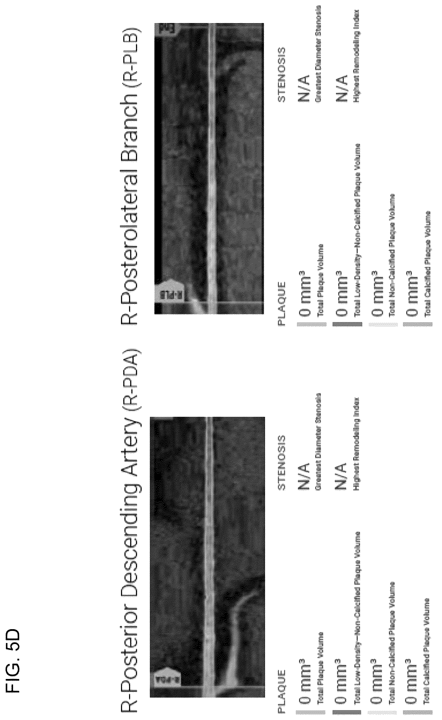 Patent US12097063 Figure 14 – Systems, methods, and devices for medical image analysis, diagnosis, risk stratification, decision making and/or disease tracking