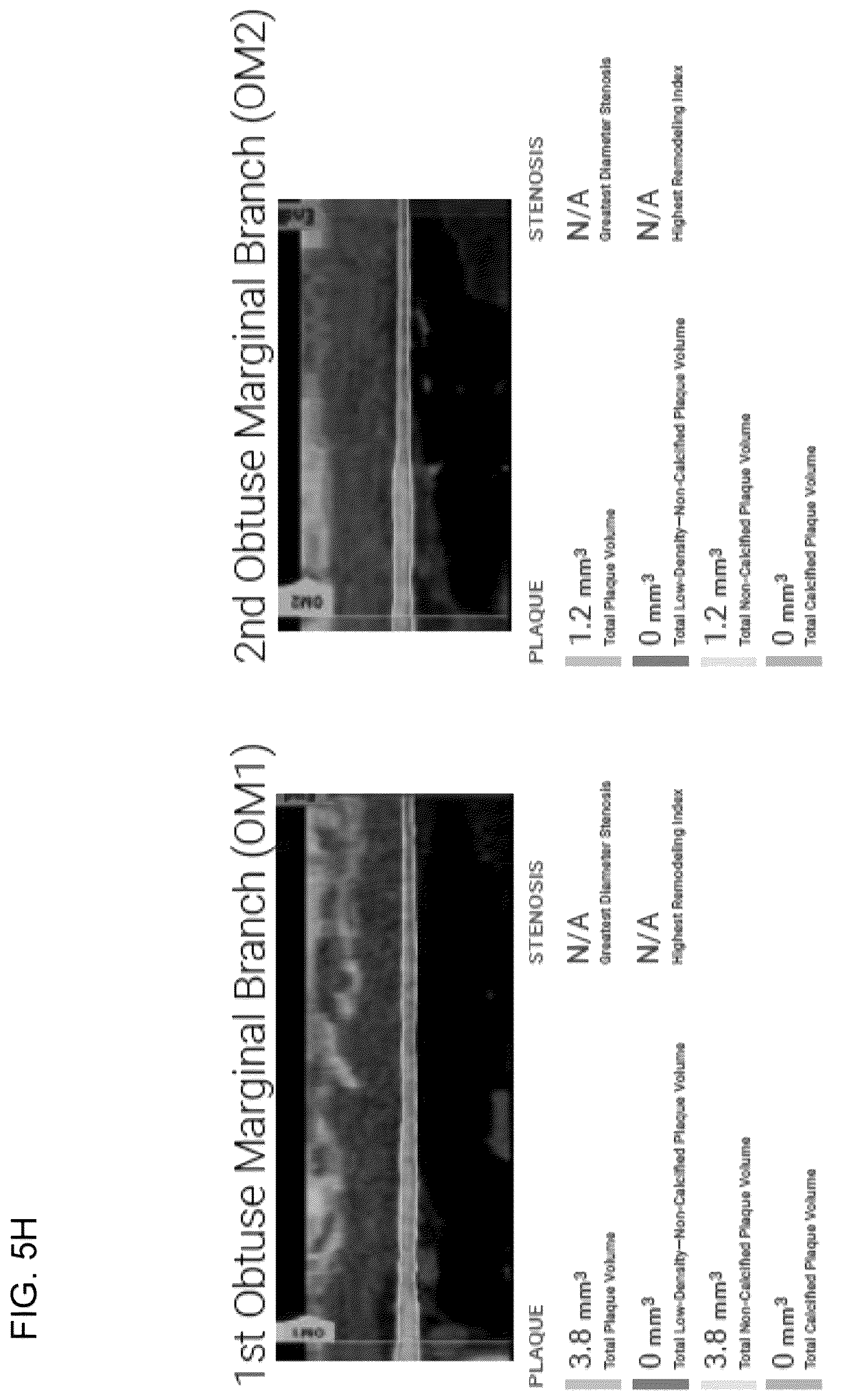 Patent US12097063 Figure 18 – Systems, methods, and devices for medical image analysis, diagnosis, risk stratification, decision making and/or disease tracking