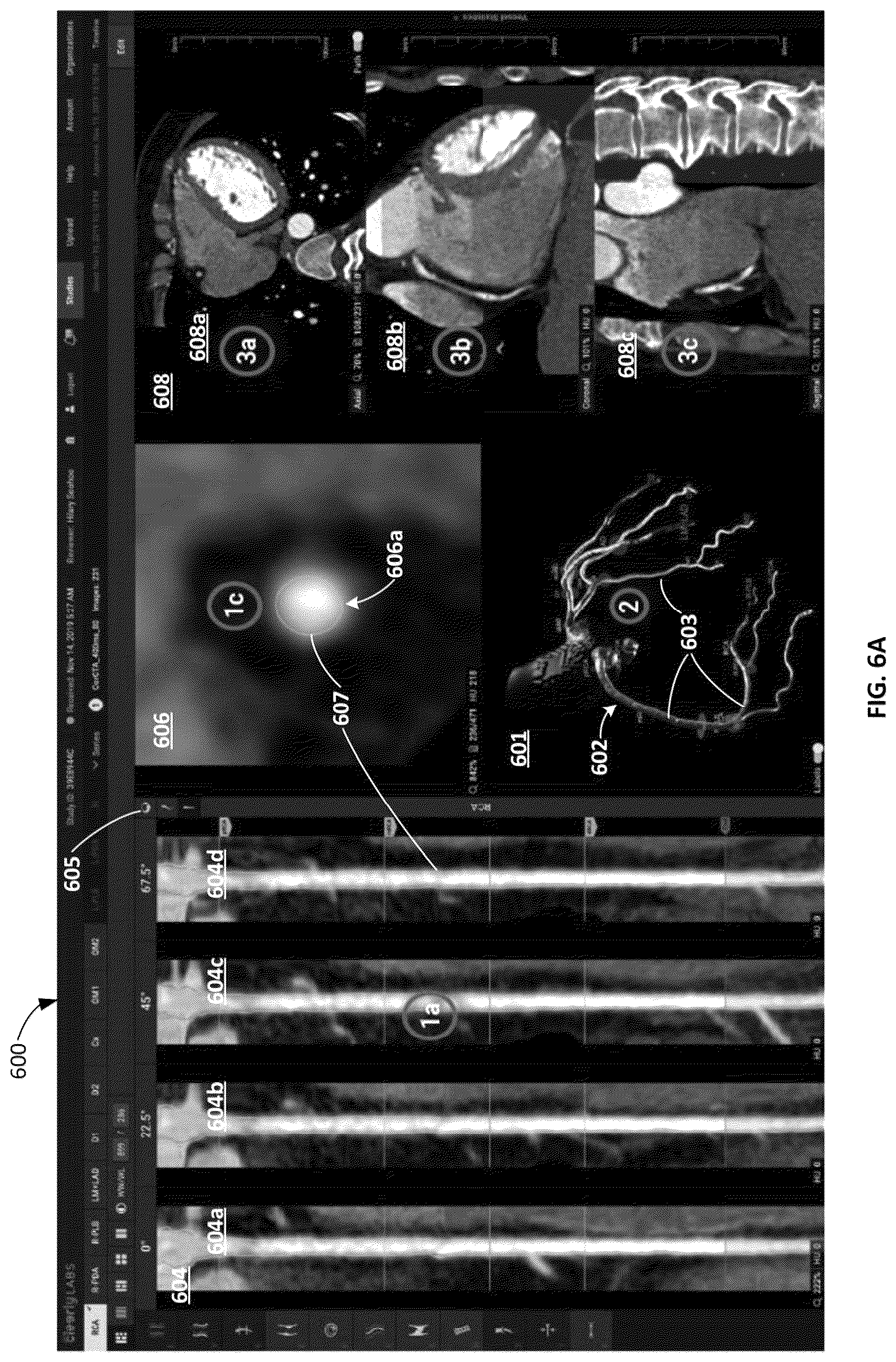 Patent US12097063 Figure 20 – Systems, methods, and devices for medical image analysis, diagnosis, risk stratification, decision making and/or disease tracking