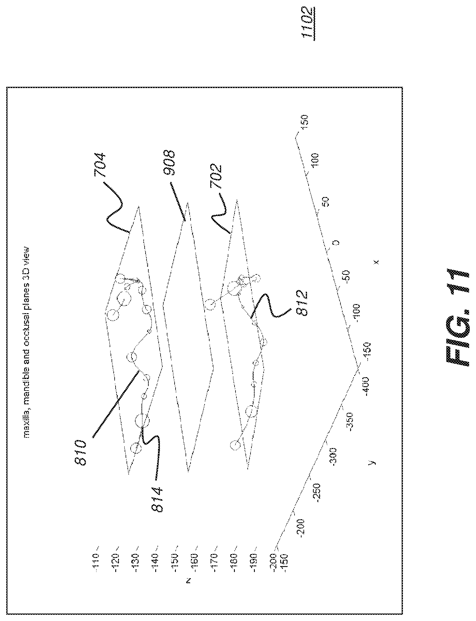 Patent US12097064 Figure 18 – Method and system for 3D cephalometric analysis