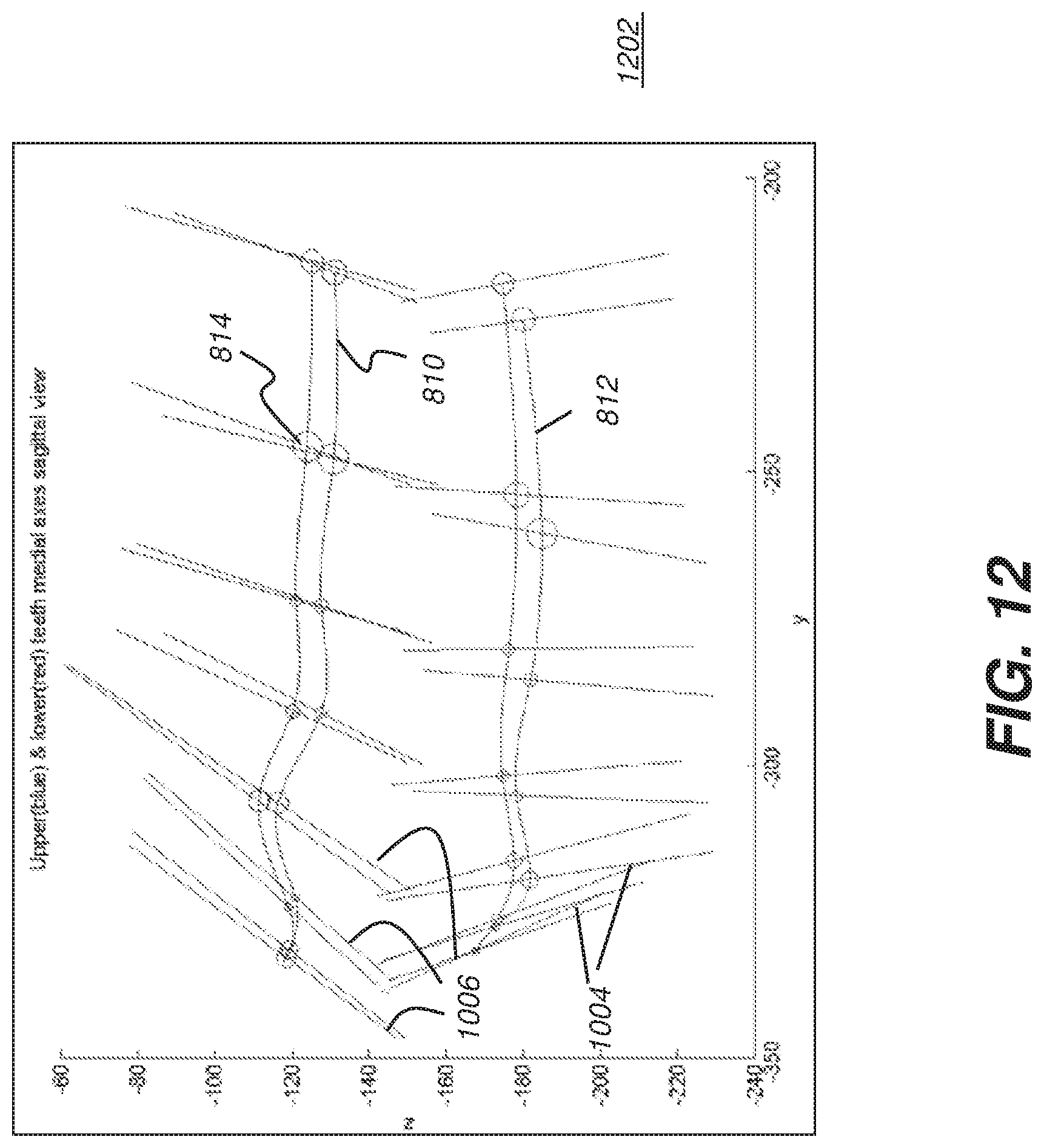 Patent US12097064 Figure 19 – Method and system for 3D cephalometric analysis