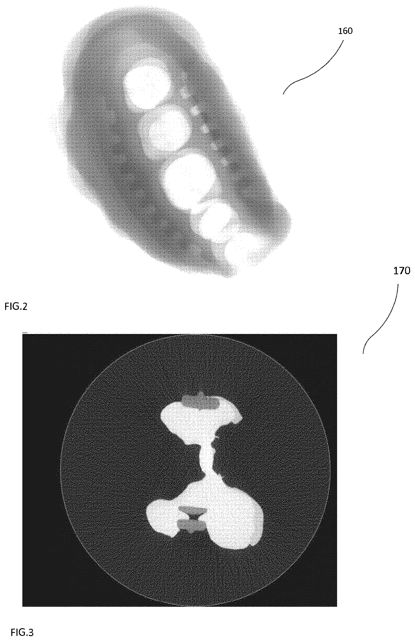 Patent US12097067 Figure 2 – Automatic determination of transfer function for CT reconstruction
