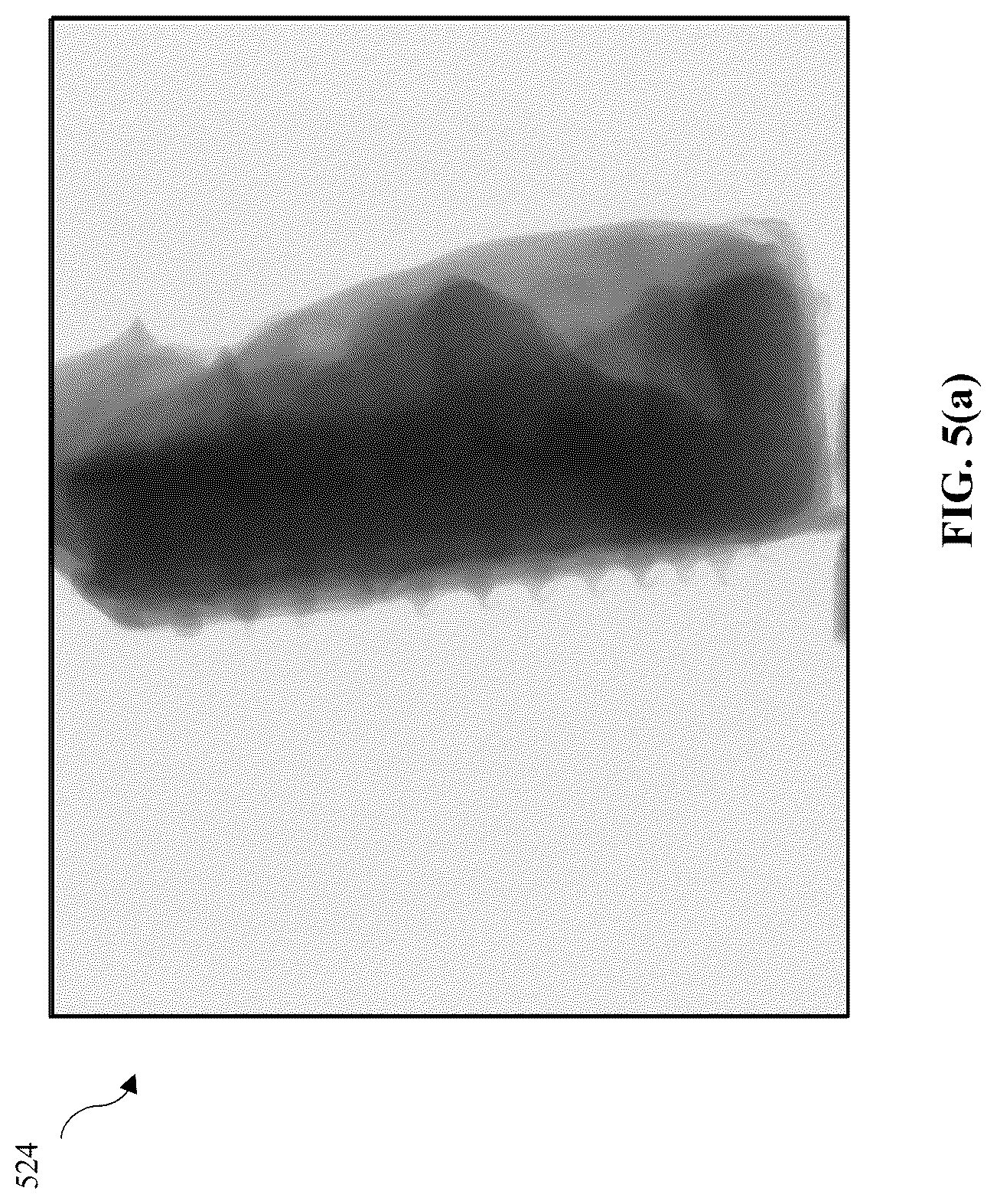 Patent US12097067 Figure 4 – Automatic determination of transfer function for CT reconstruction