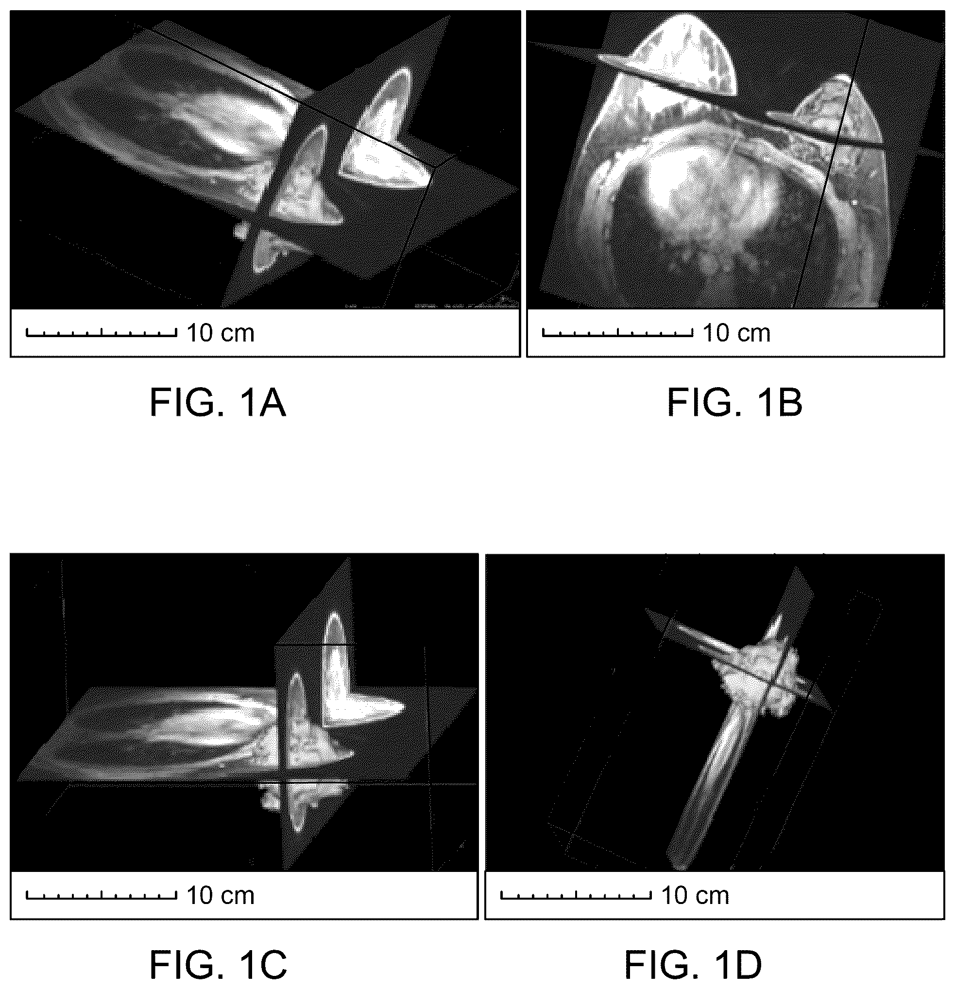 Patent US12097068 — Multisegment breast tissue mimic — Figure 1