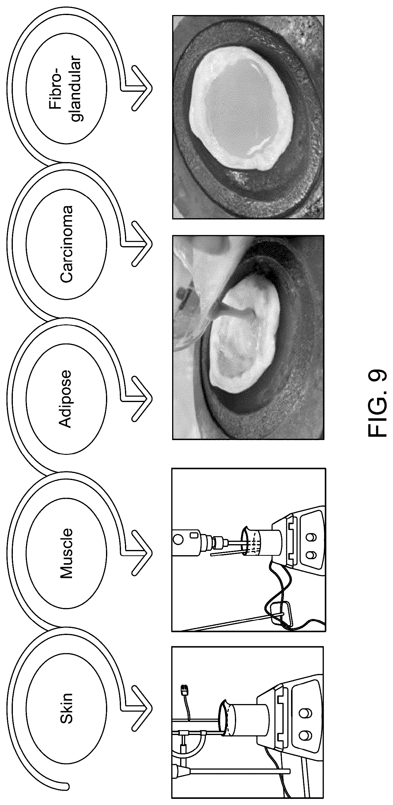 Patent US12097068 Figure 9 – Multisegment breast tissue mimic