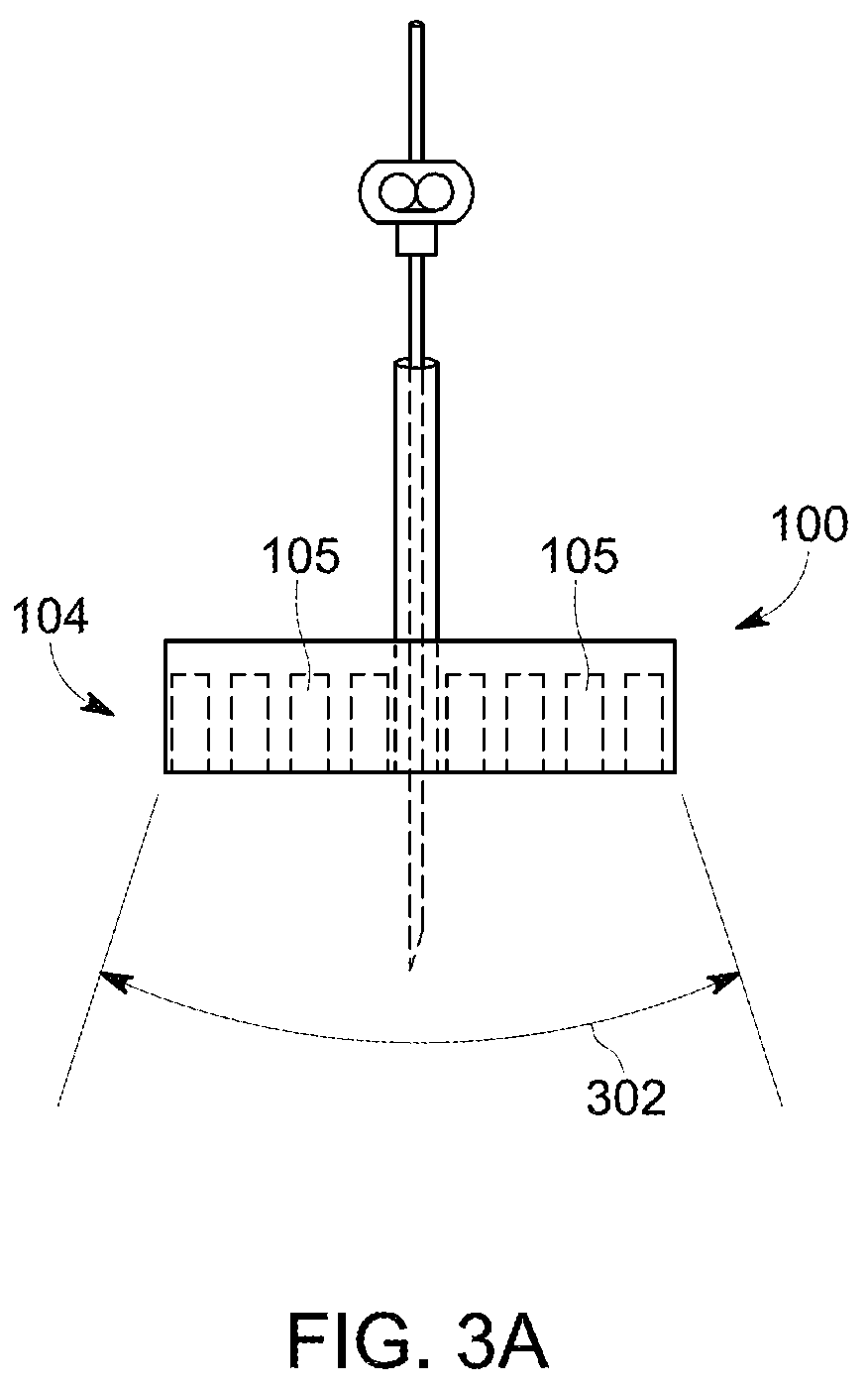 Patent US12097069 Figure 3 – Ultrasound probe with an integrated needle assembly and a computer program product, a method and a system for providing a path for inserting a needle of the ultrasound probe