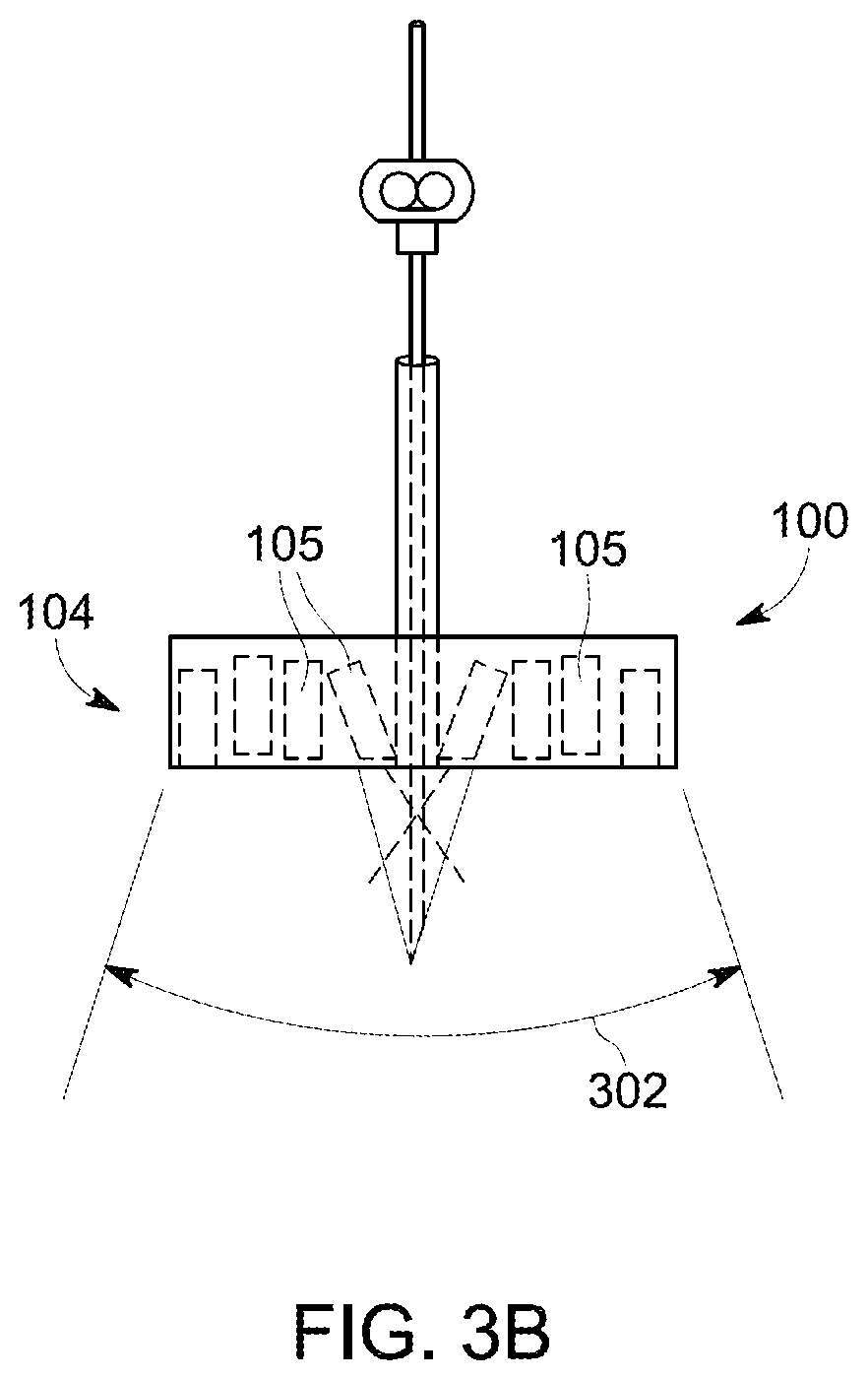 Patent US12097069 Figure 4 – Ultrasound probe with an integrated needle assembly and a computer program product, a method and a system for providing a path for inserting a needle of the ultrasound probe
