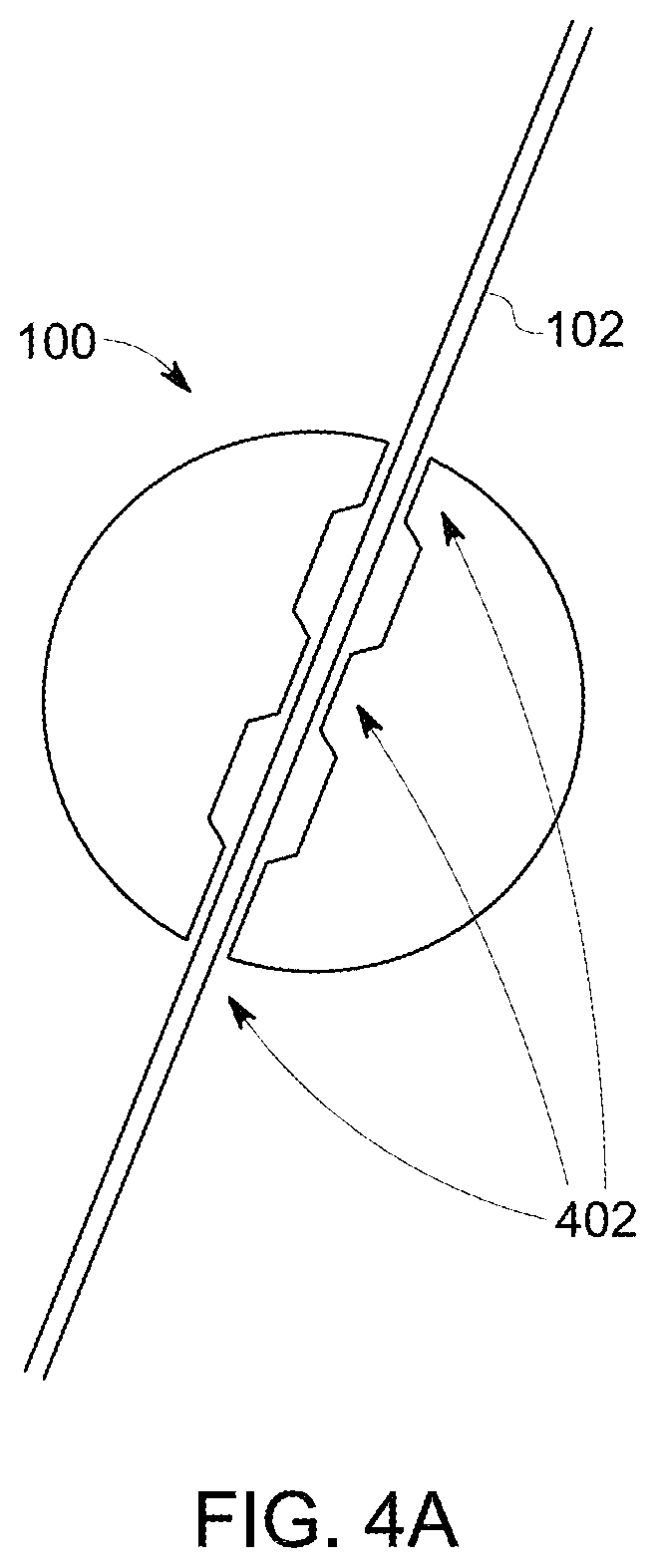 Patent US12097069 Figure 5 – Ultrasound probe with an integrated needle assembly and a computer program product, a method and a system for providing a path for inserting a needle of the ultrasound probe