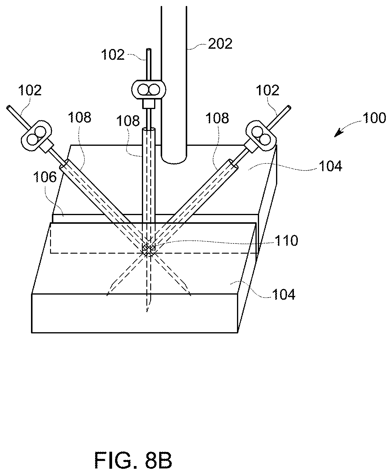 Patent US12097069 Figure 11 – Ultrasound probe with an integrated needle assembly and a computer program product, a method and a system for providing a path for inserting a needle of the ultrasound probe