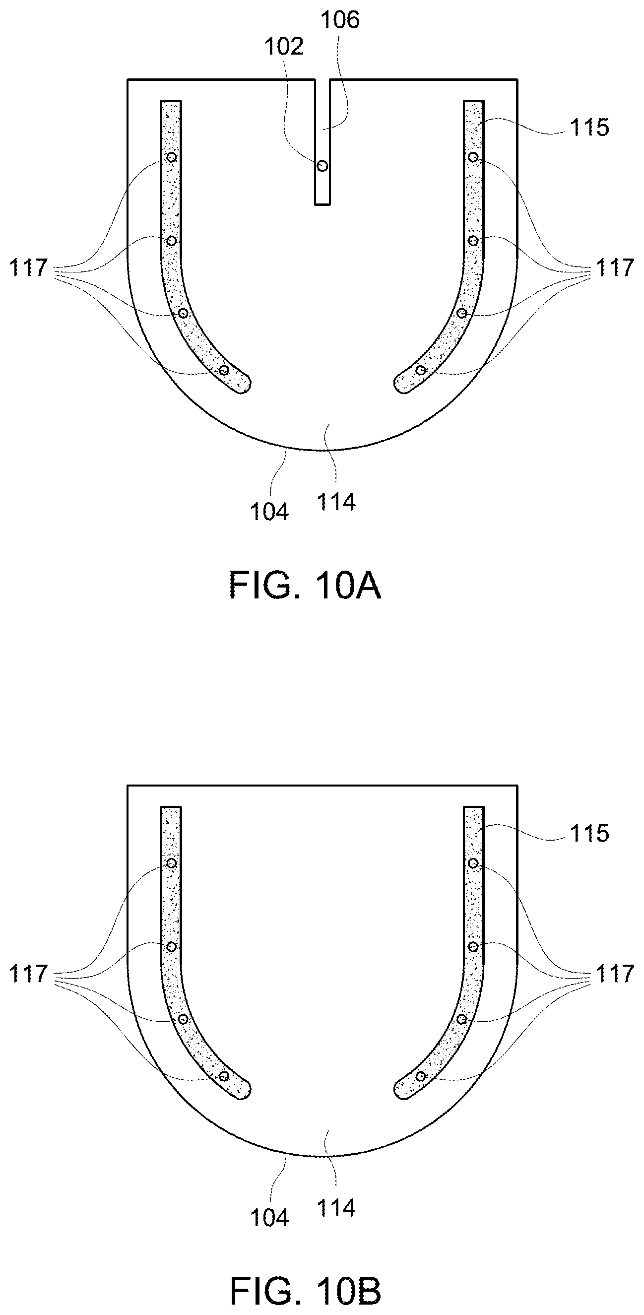 Patent US12097069 Figure 15 – Ultrasound probe with an integrated needle assembly and a computer program product, a method and a system for providing a path for inserting a needle of the ultrasound probe