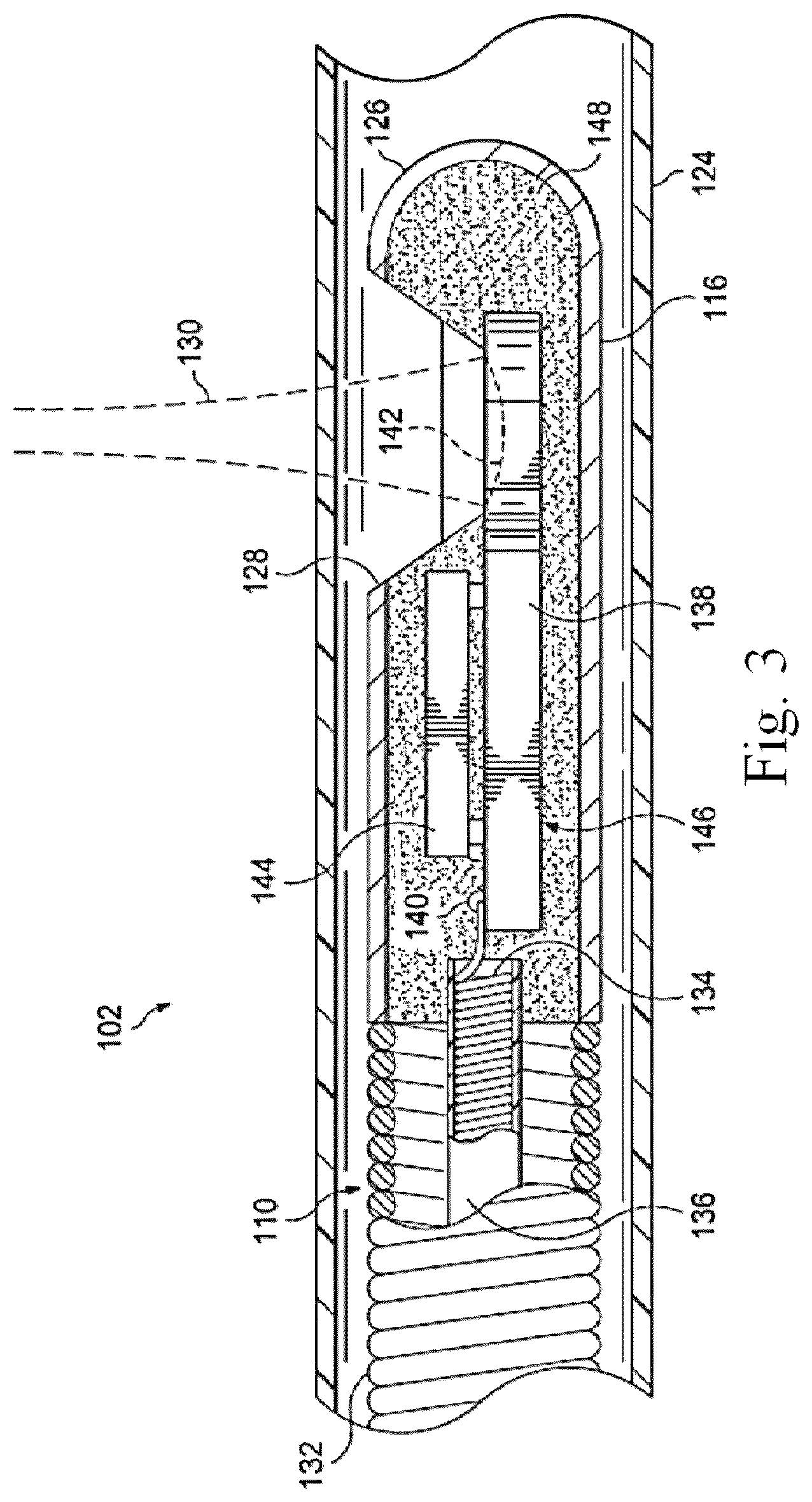 Patent US12097072 Figure 3 – Interconnects for intravascular ultrasound (IVUS) devices
