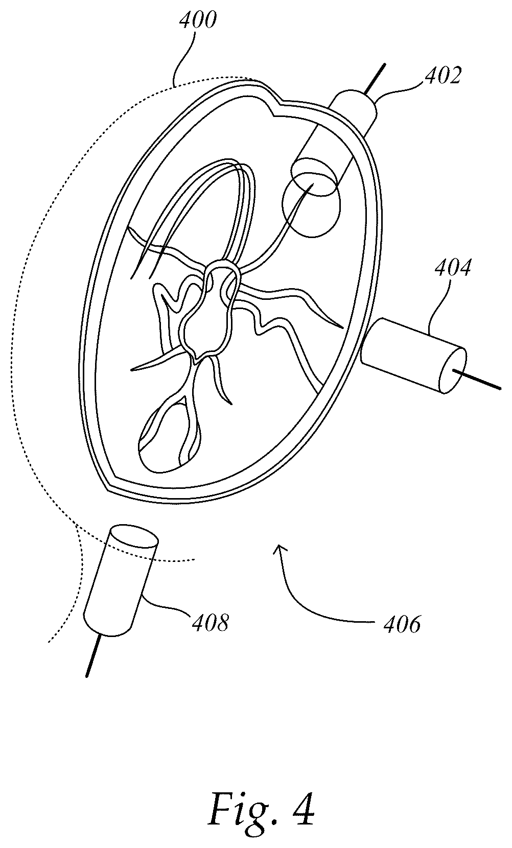 Patent US12097073 Figure 4 – Systems and methods for determining clinical indications