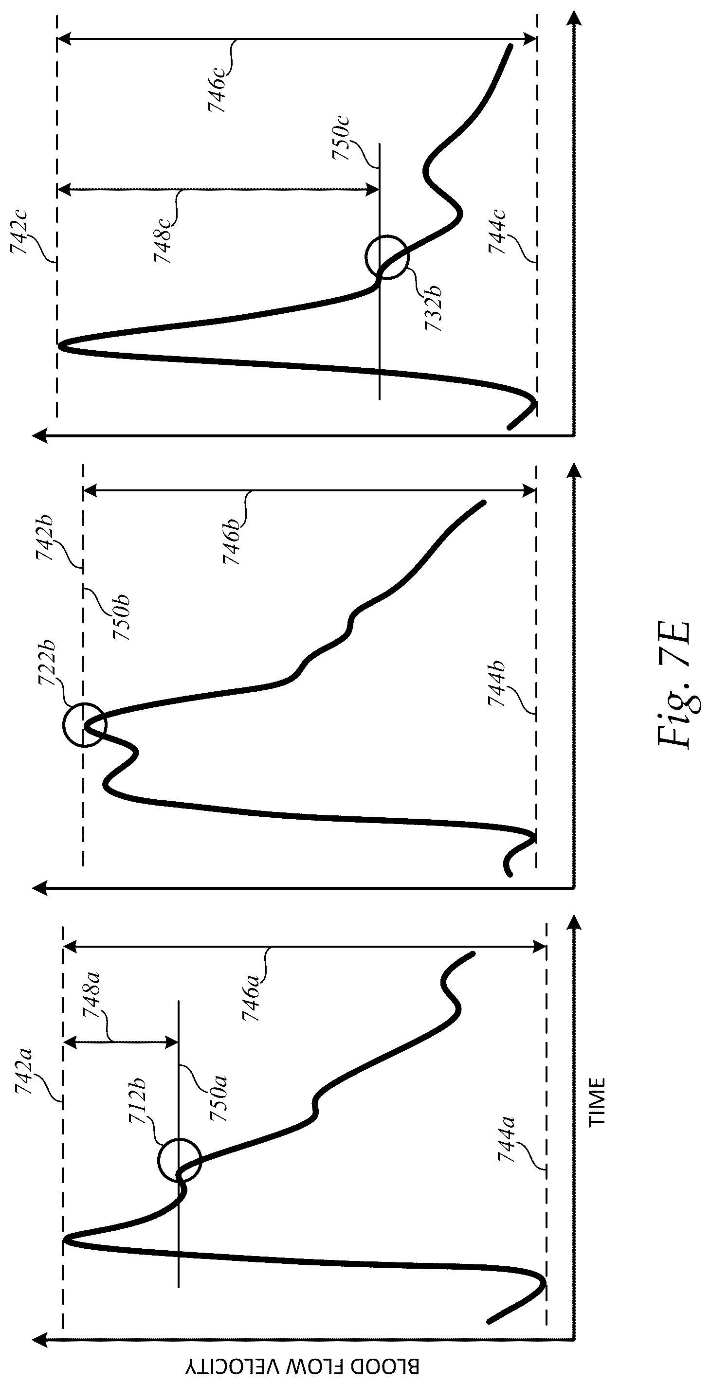 Patent US12097073 Figure 12 – Systems and methods for determining clinical indications