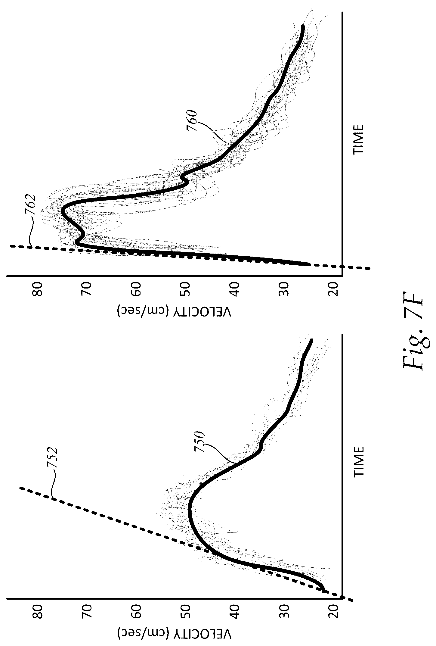 Patent US12097073 Figure 13 – Systems and methods for determining clinical indications
