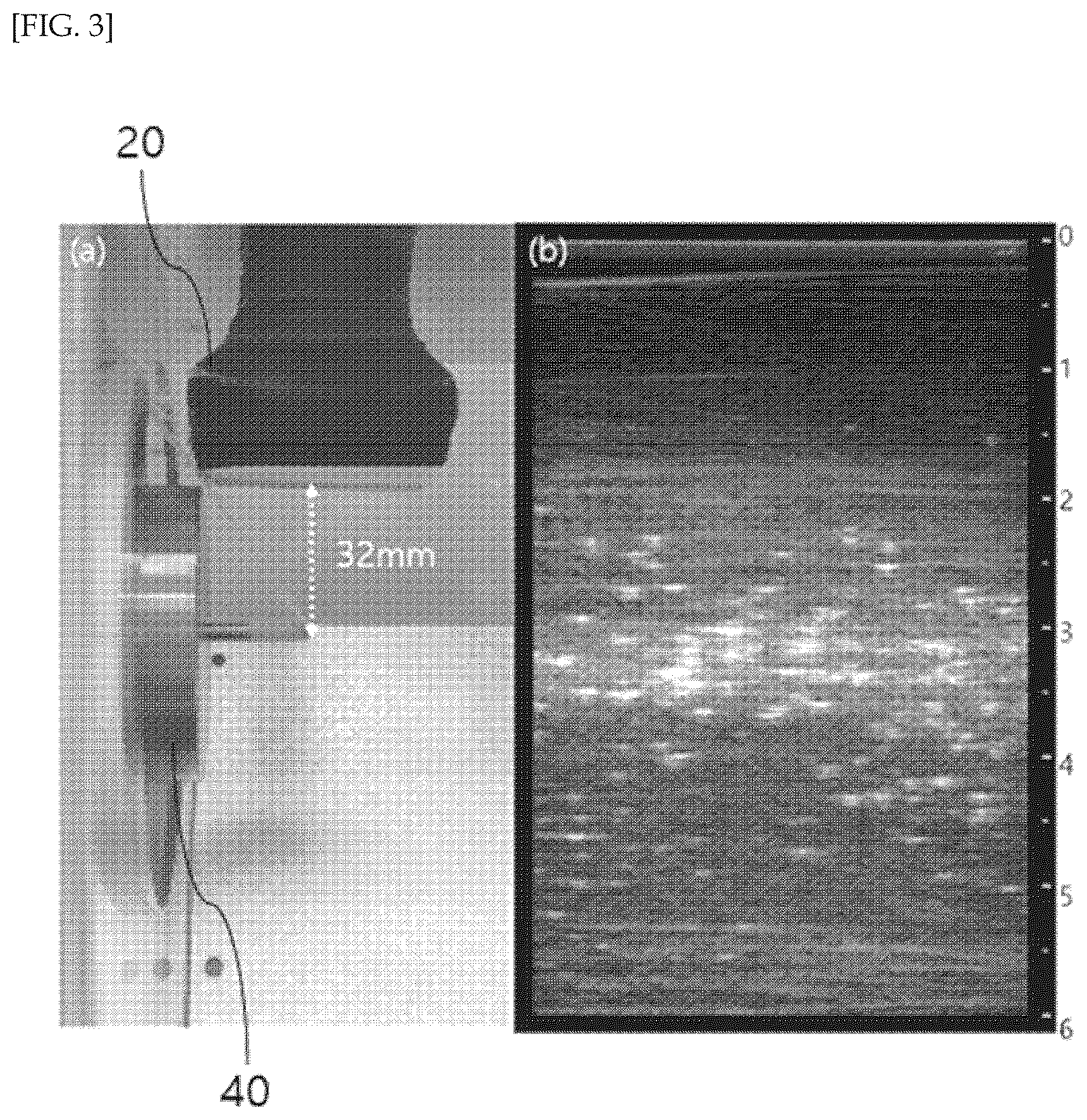 Patent US12097076 Figure 3 – Method and device for displaying passive cavitation image