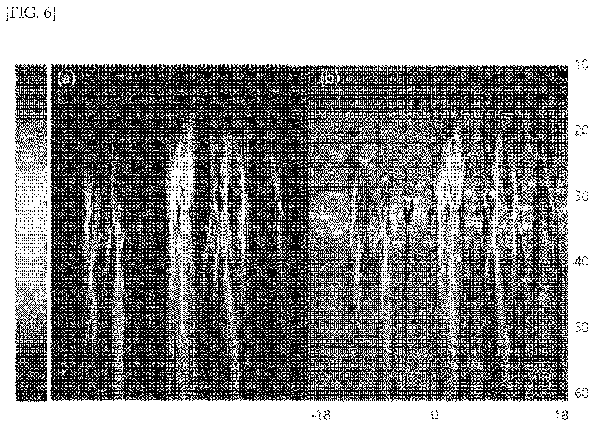 Patent US12097076 Figure 6 – Method and device for displaying passive cavitation image