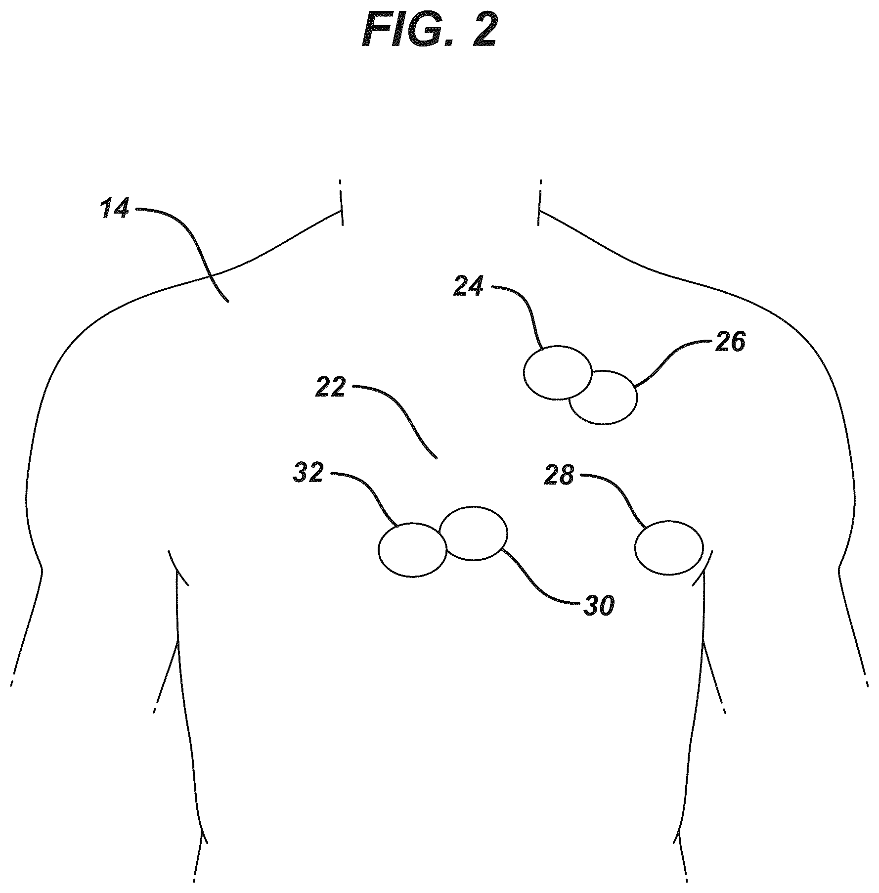 Patent US12097077 Figure 2 – Methods and systems for detecting heart conditions using medical imaging