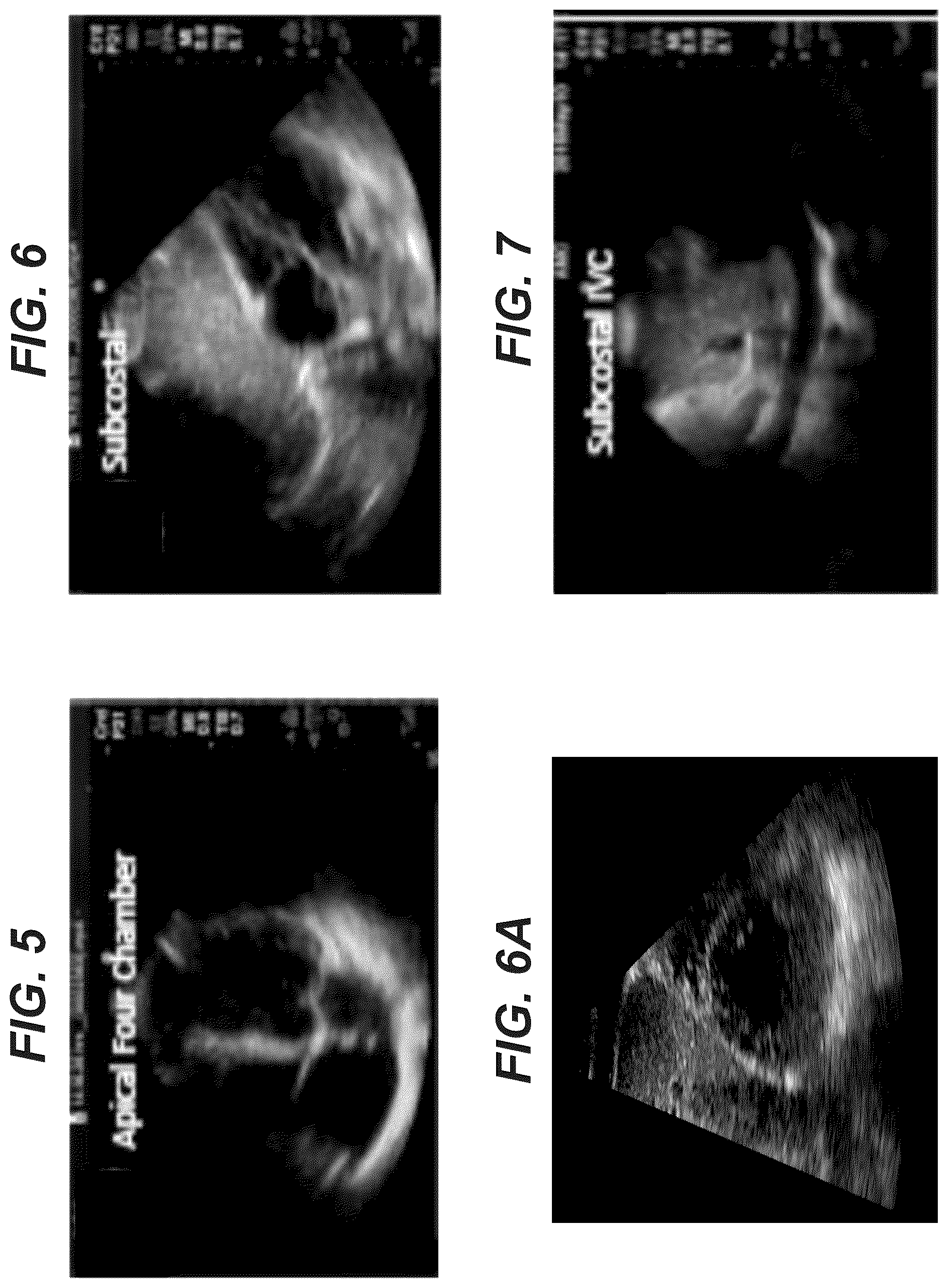 Patent US12097077 Figure 4 – Methods and systems for detecting heart conditions using medical imaging